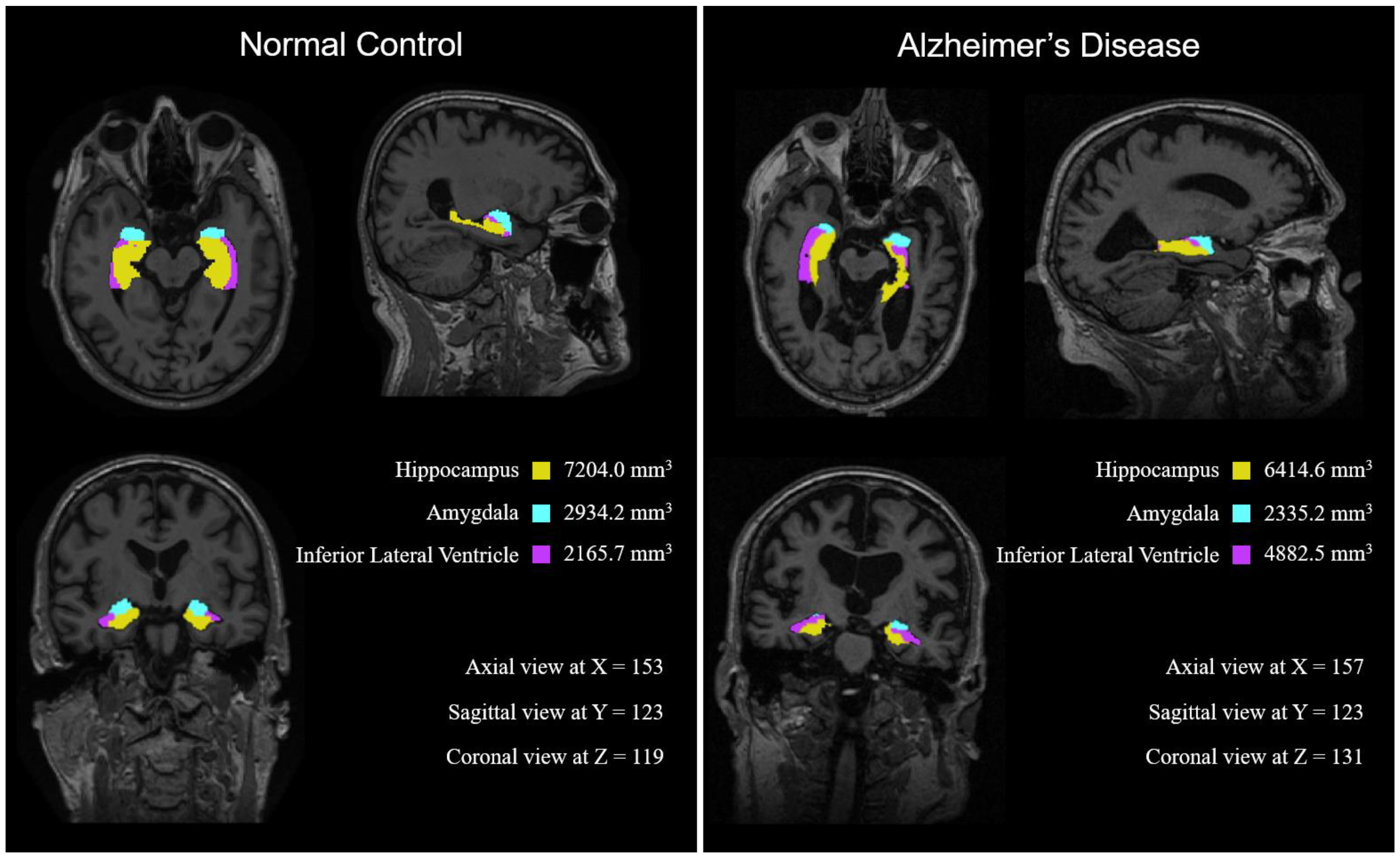 Brainsci 11 00453 g006
