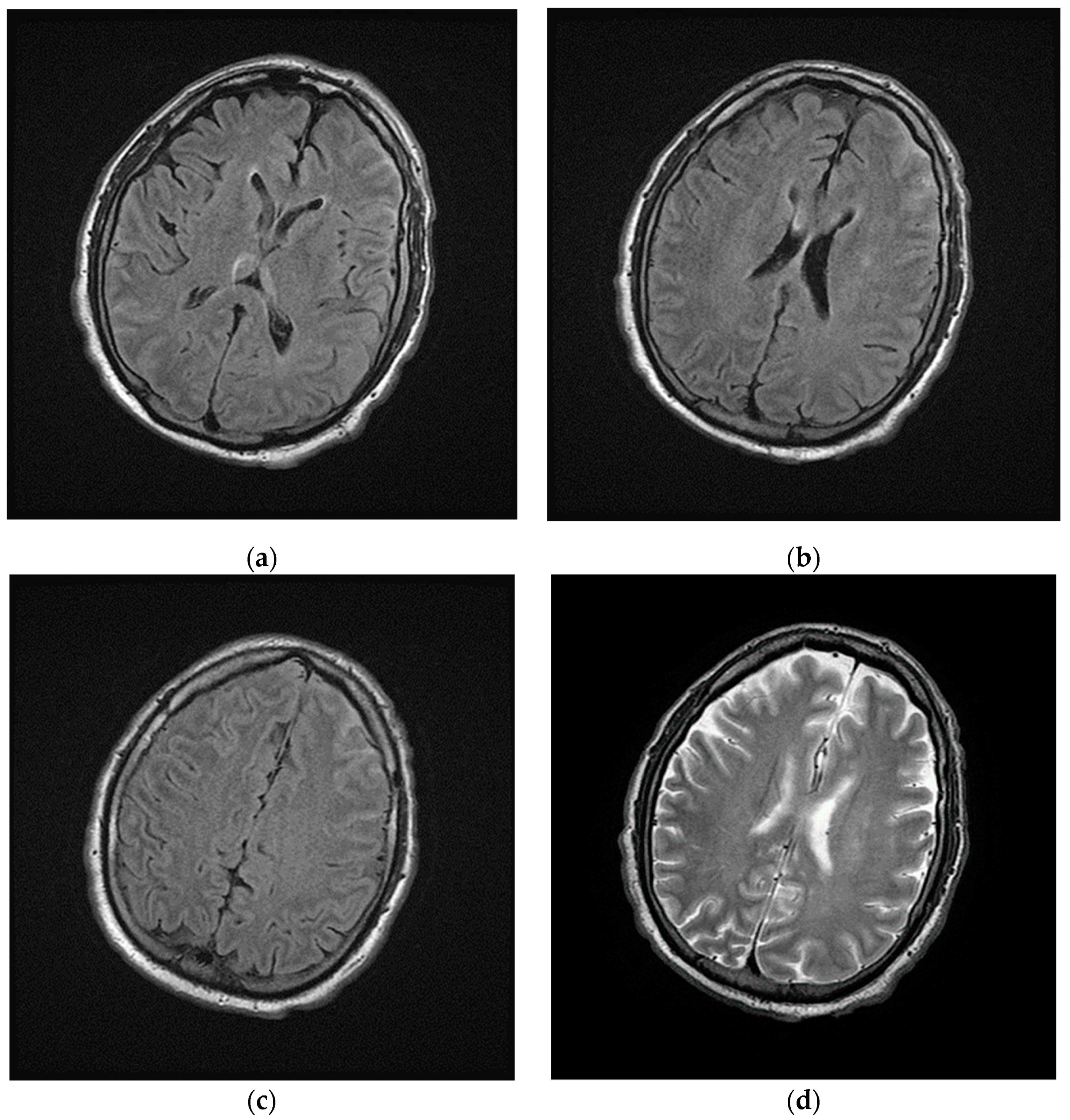 Brainsci 11 00454 g002 Brainsci 11 00454 g002
