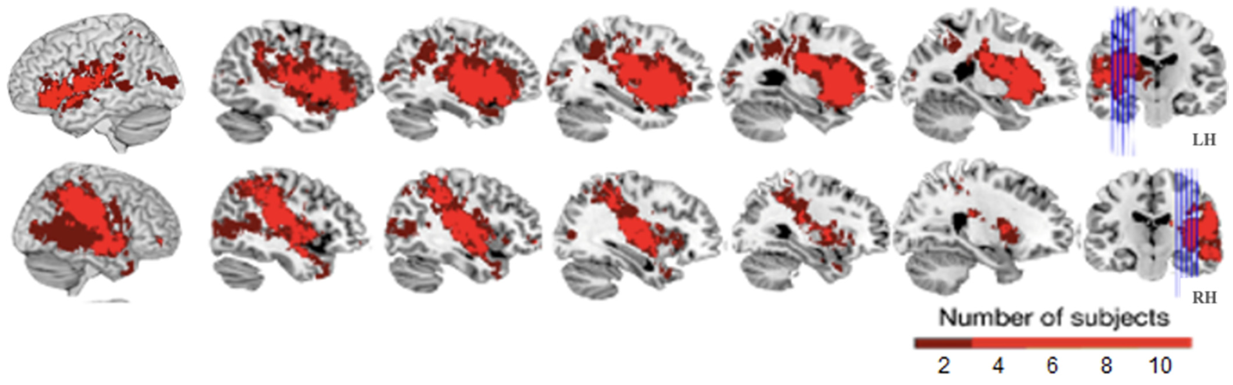 Brainsci 11 00474 g001