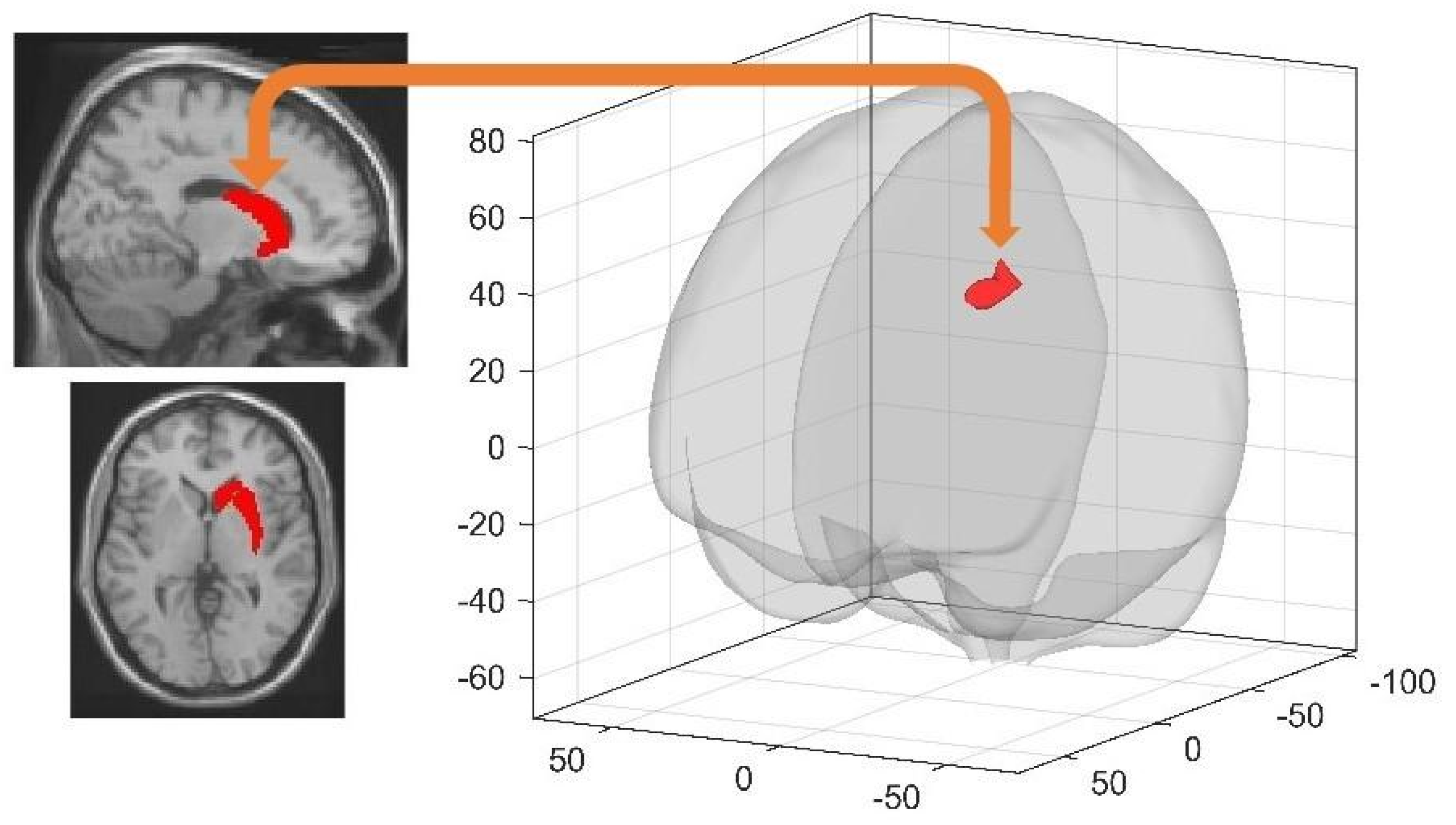 PDF) Diurnal oscillations of MRI metrics in the brains of male participants