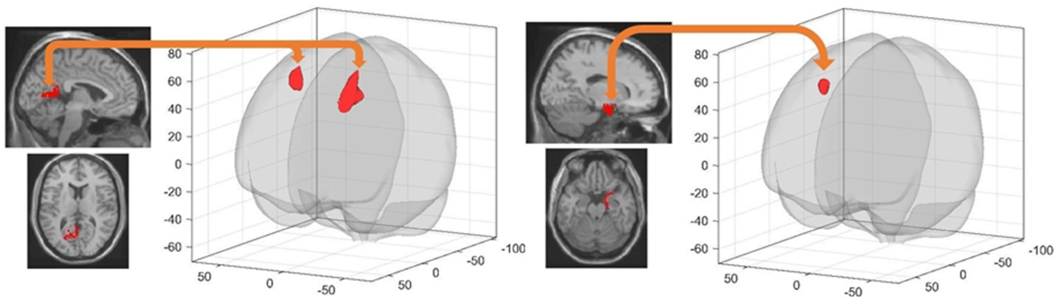 Brainsci 11 00476 g003 Brainsci 11 00476 g003