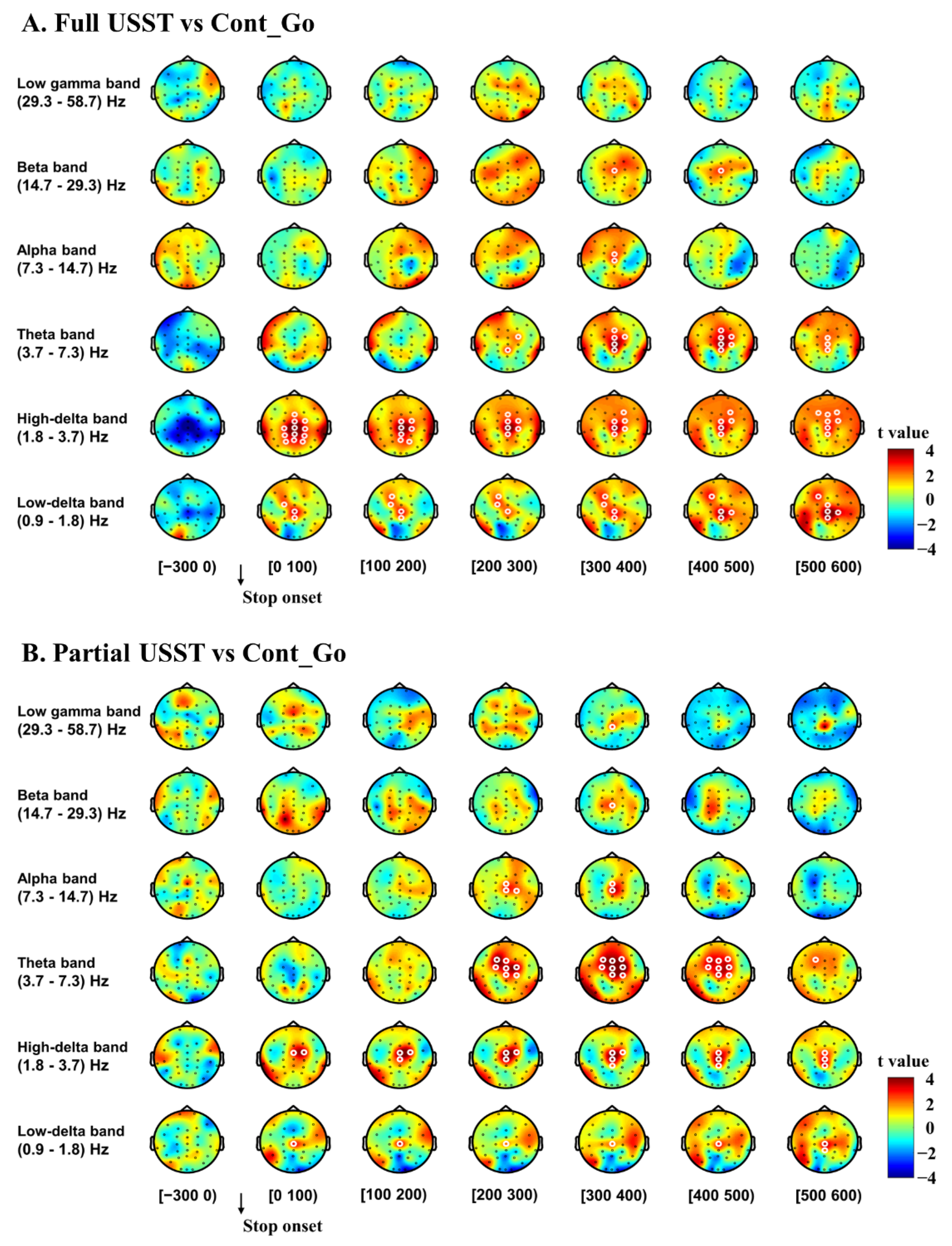 Dynamical EEG Indices of Progressive Motor Inhibition and