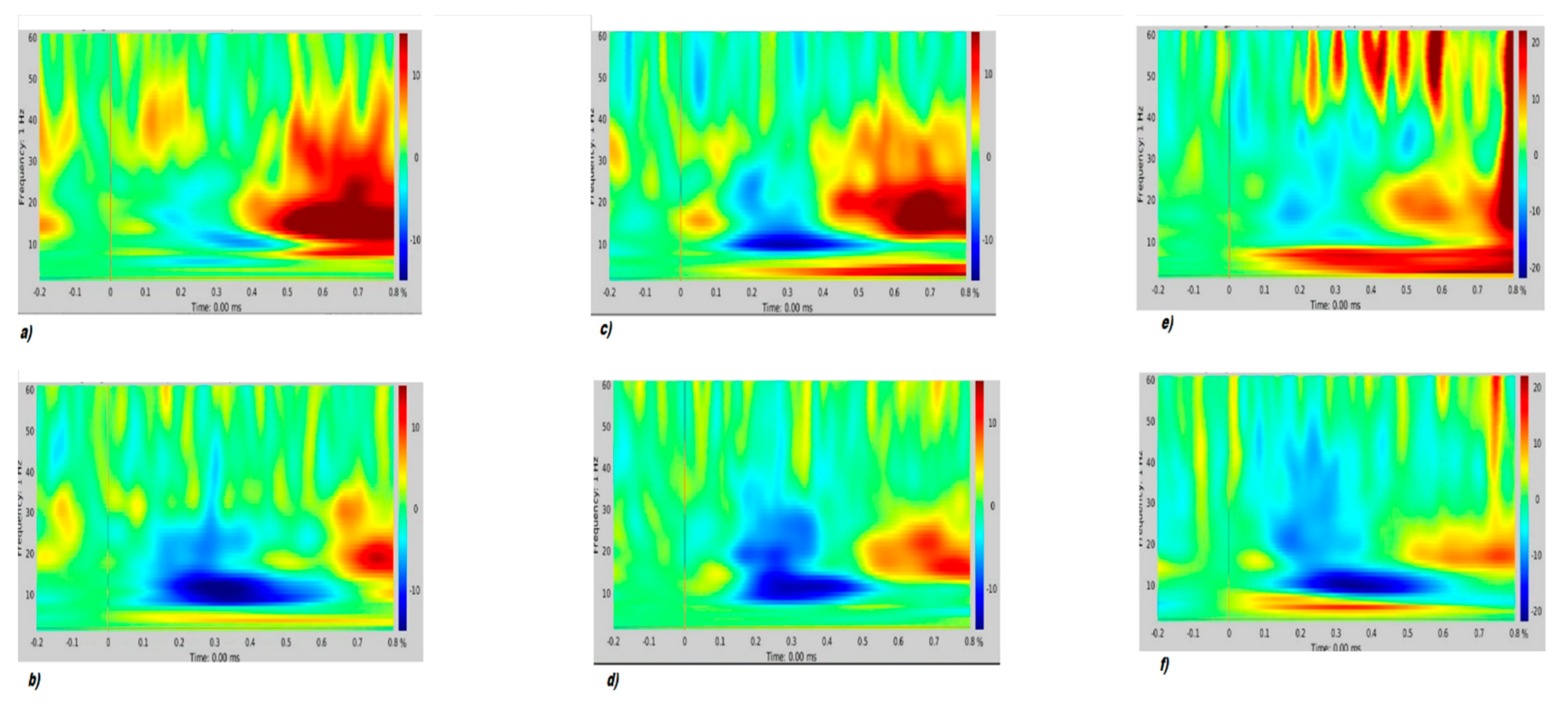 Brainsci 11 00481 g003 Brainsci 11 00481 g003