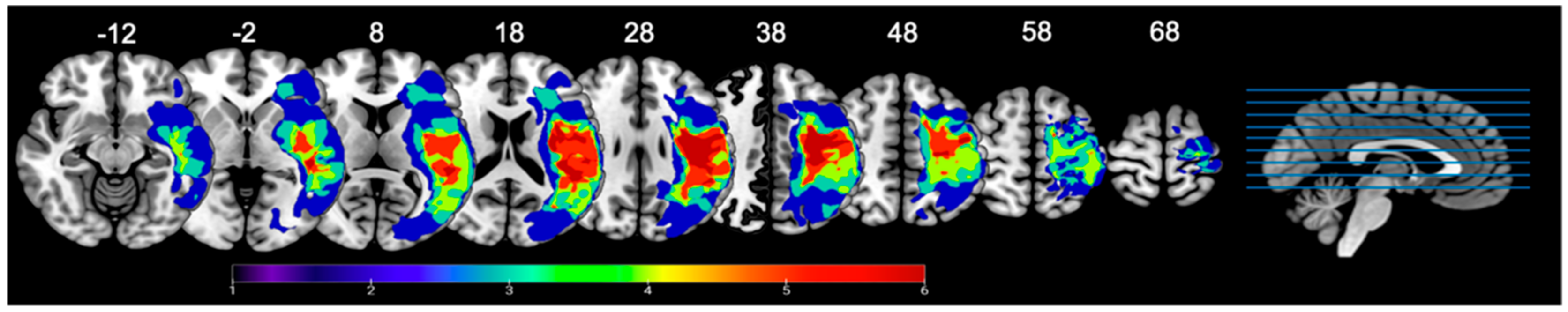 Brainsci 11 00491 g001 Brainsci 11 00491 g001