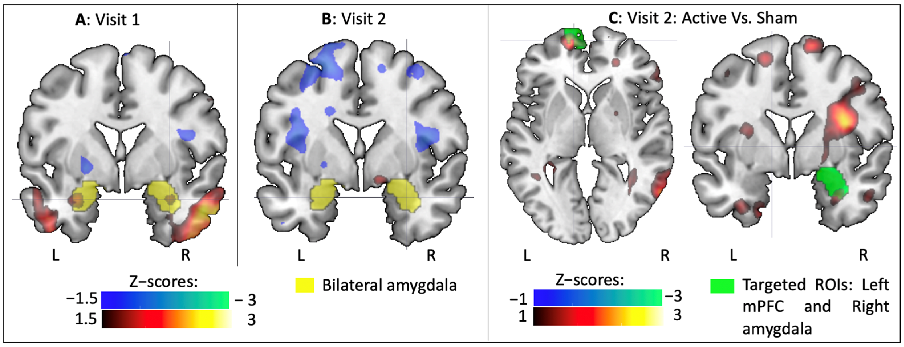 Brainsci 11 00494 g004