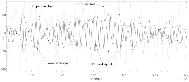 EEG—Single-Channel Envelope Synchronisation and