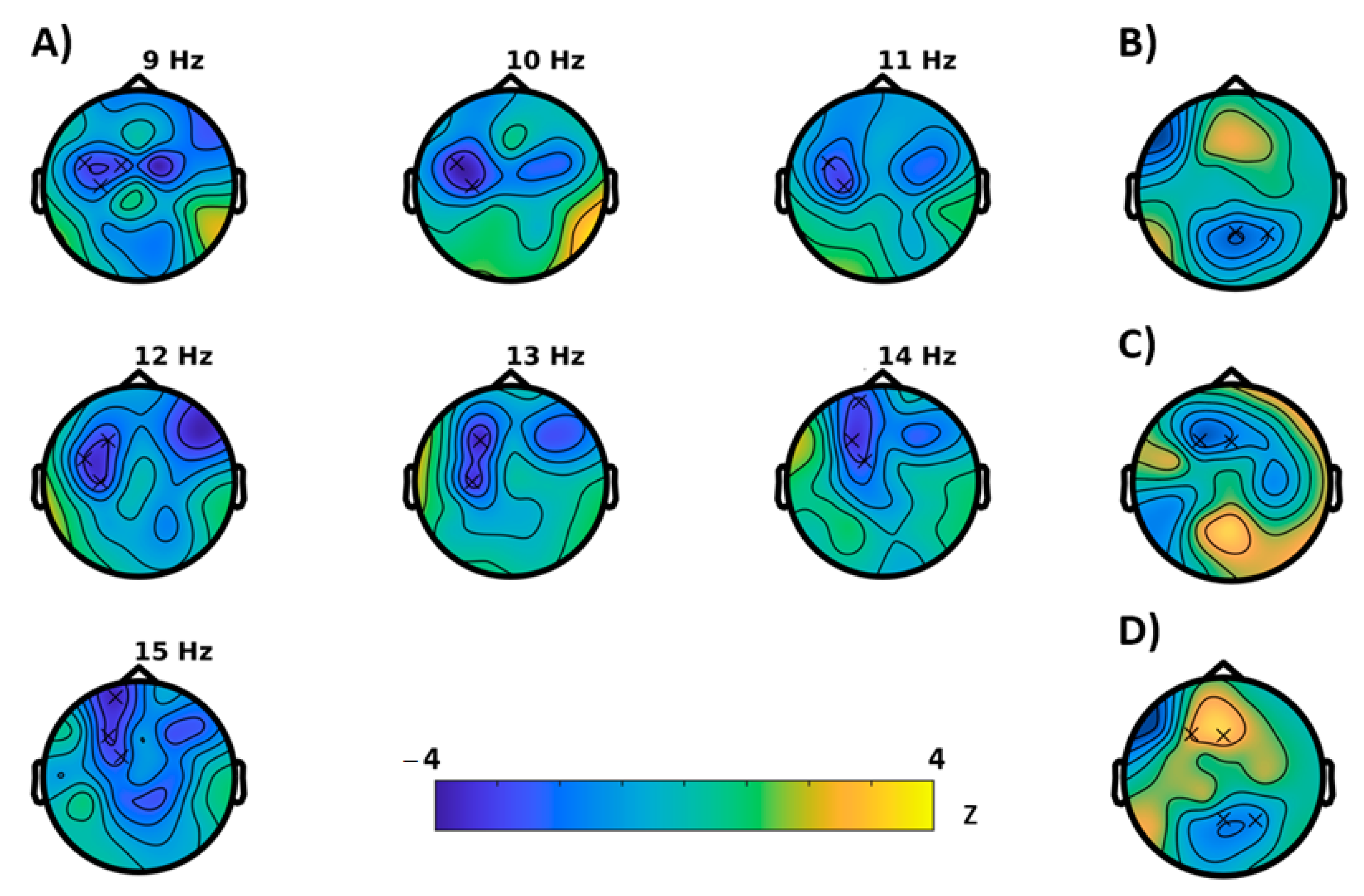Brain Sciences Free Full Text Cognitive Effects Of Montelukast A Pharmaco Eeg Study Html