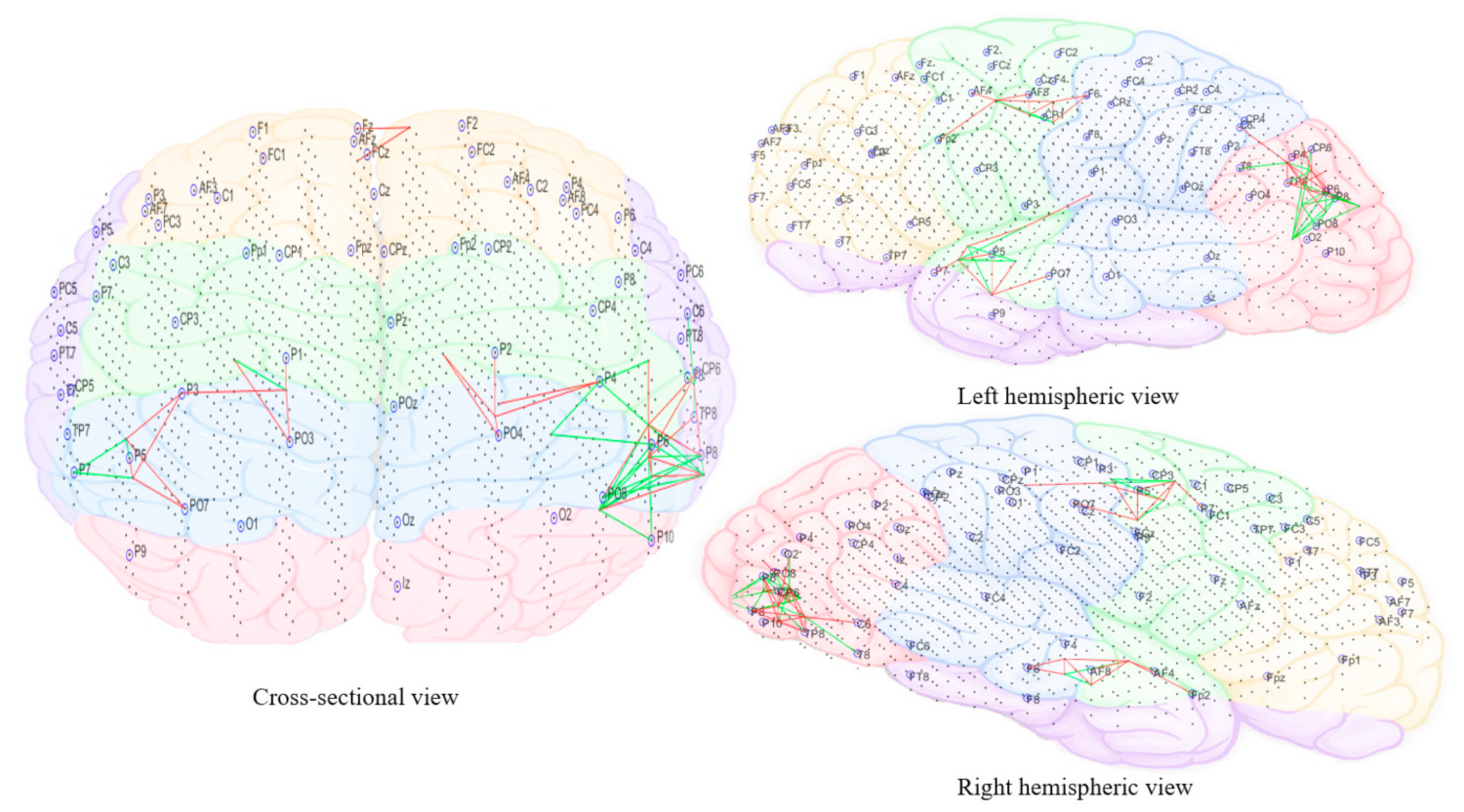 Brainsci 11 00554 g013