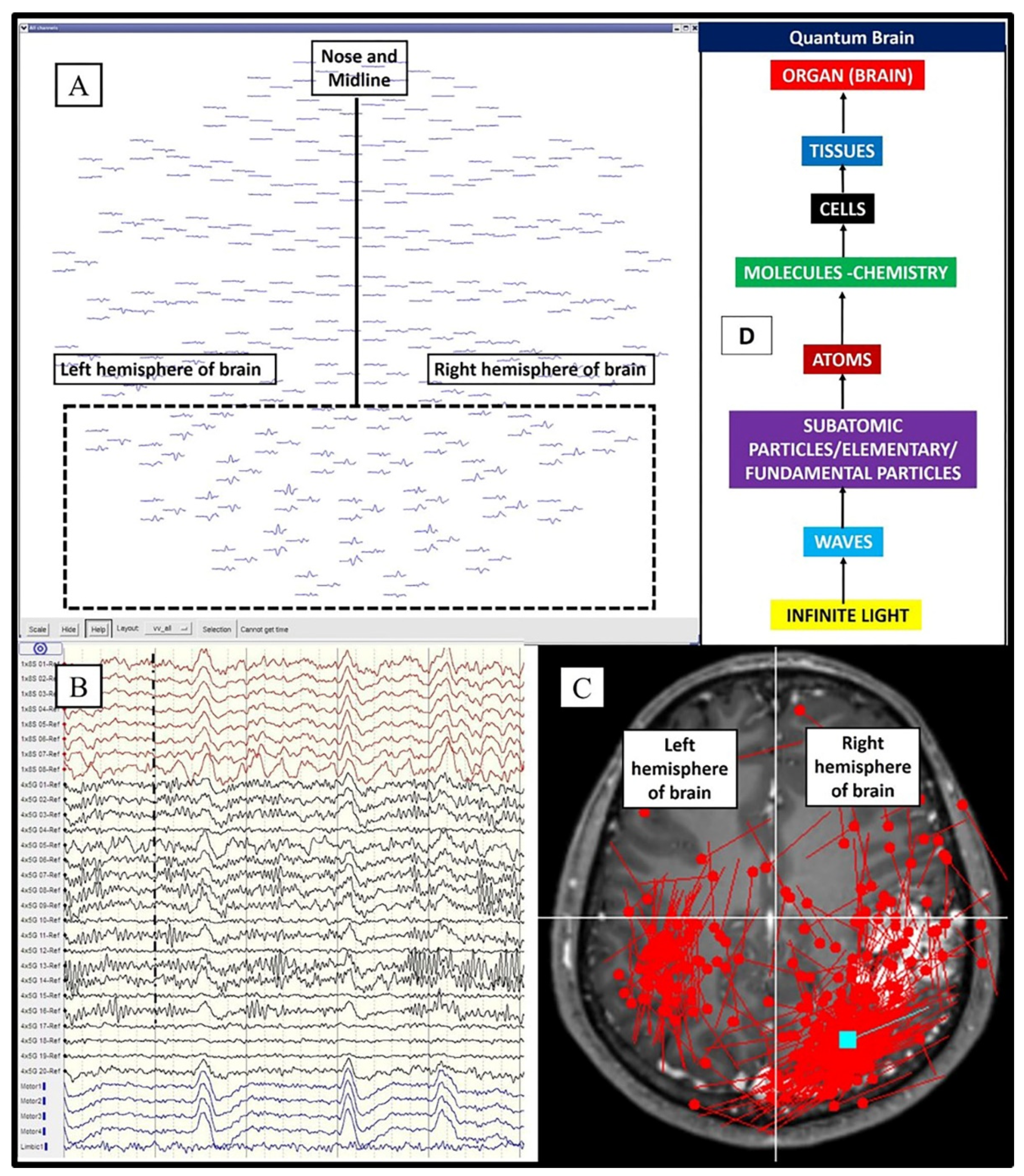 Brainsci 11 00558 g005 Brainsci 11 00558 g005