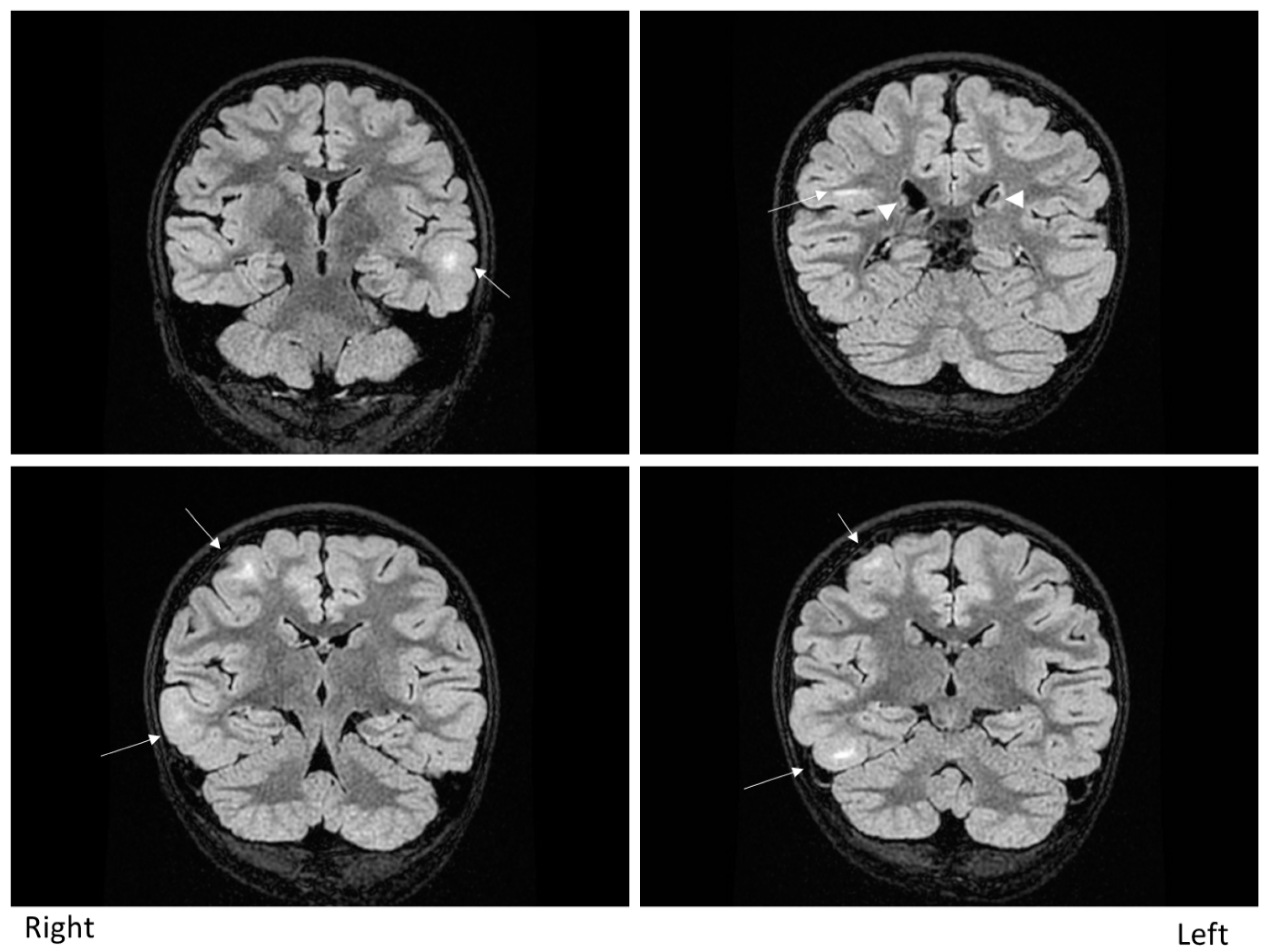 Brainsci 11 00568 g001