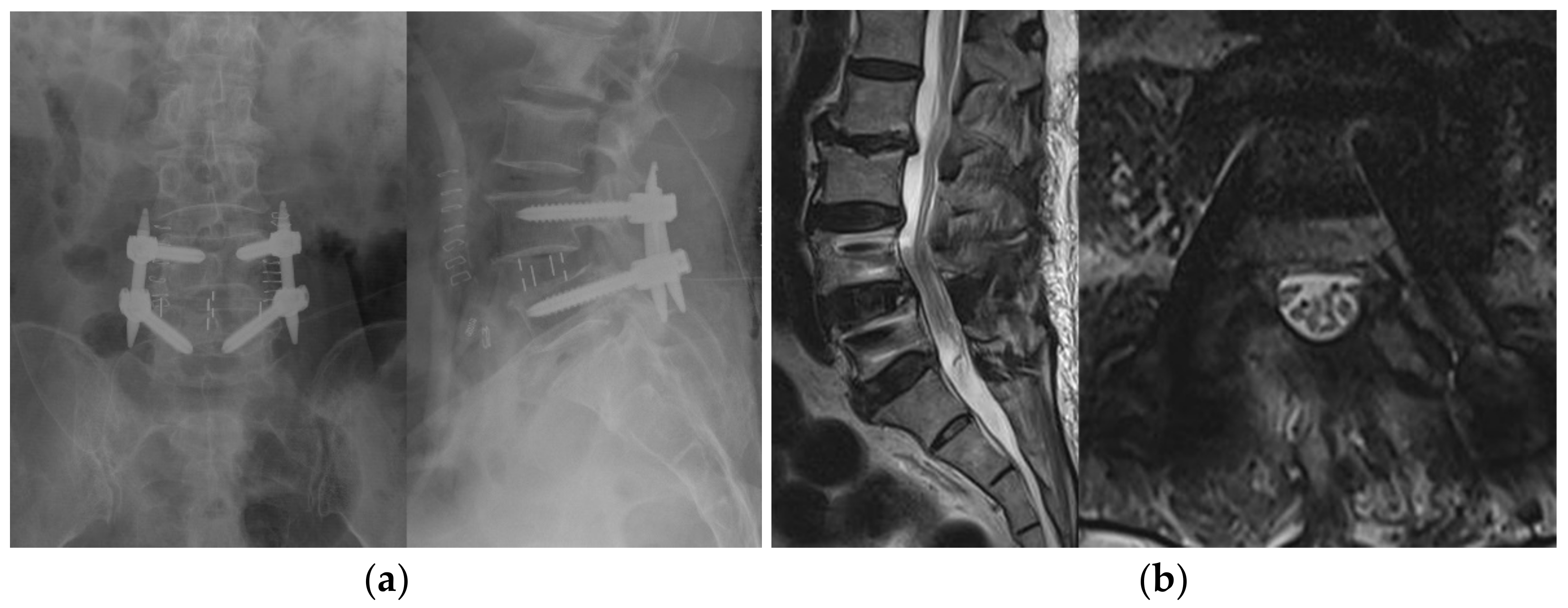 Brainsci 11 00630 g003 Brainsci 11 00630 g003