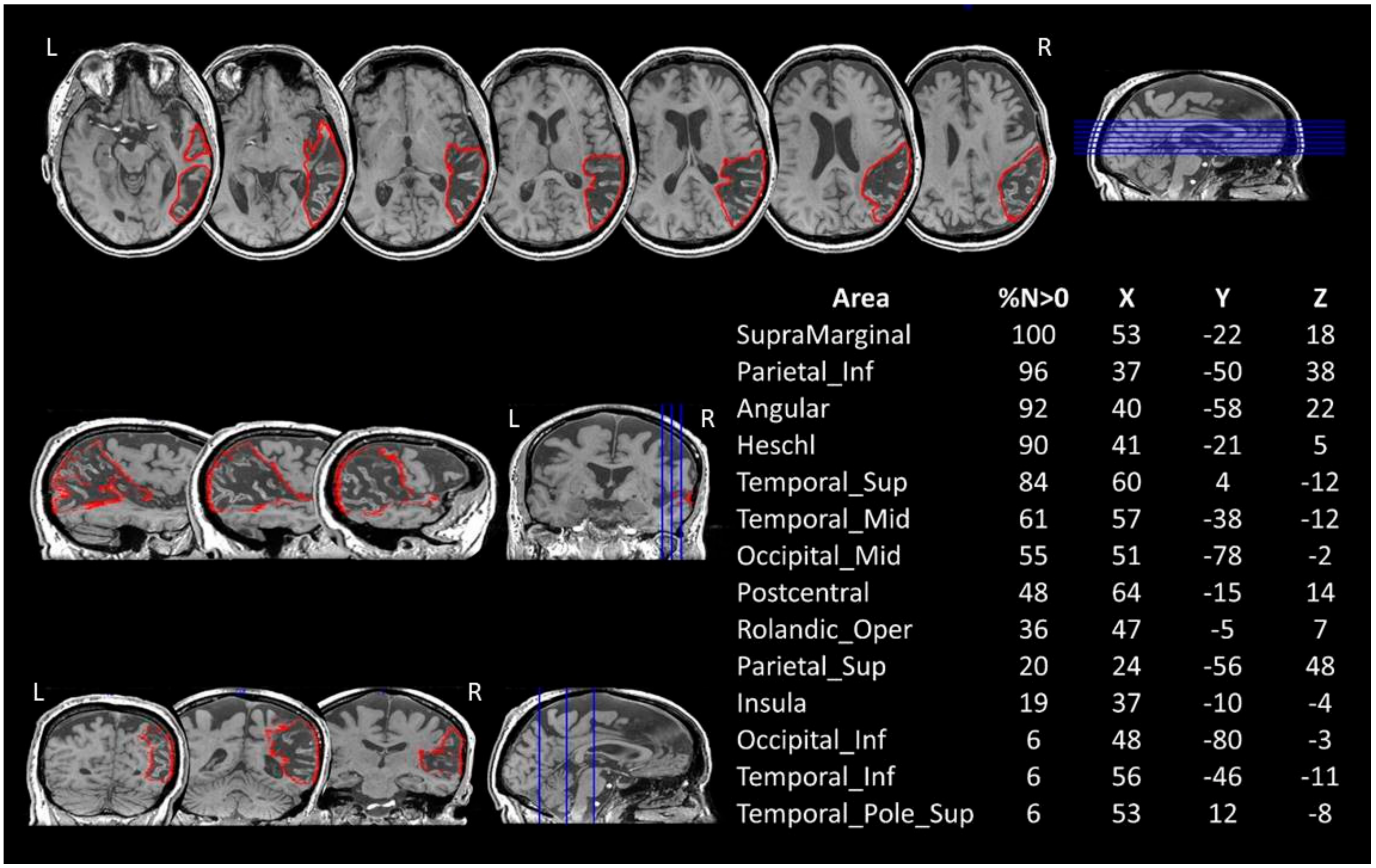 Brainsci 11 00632 g001