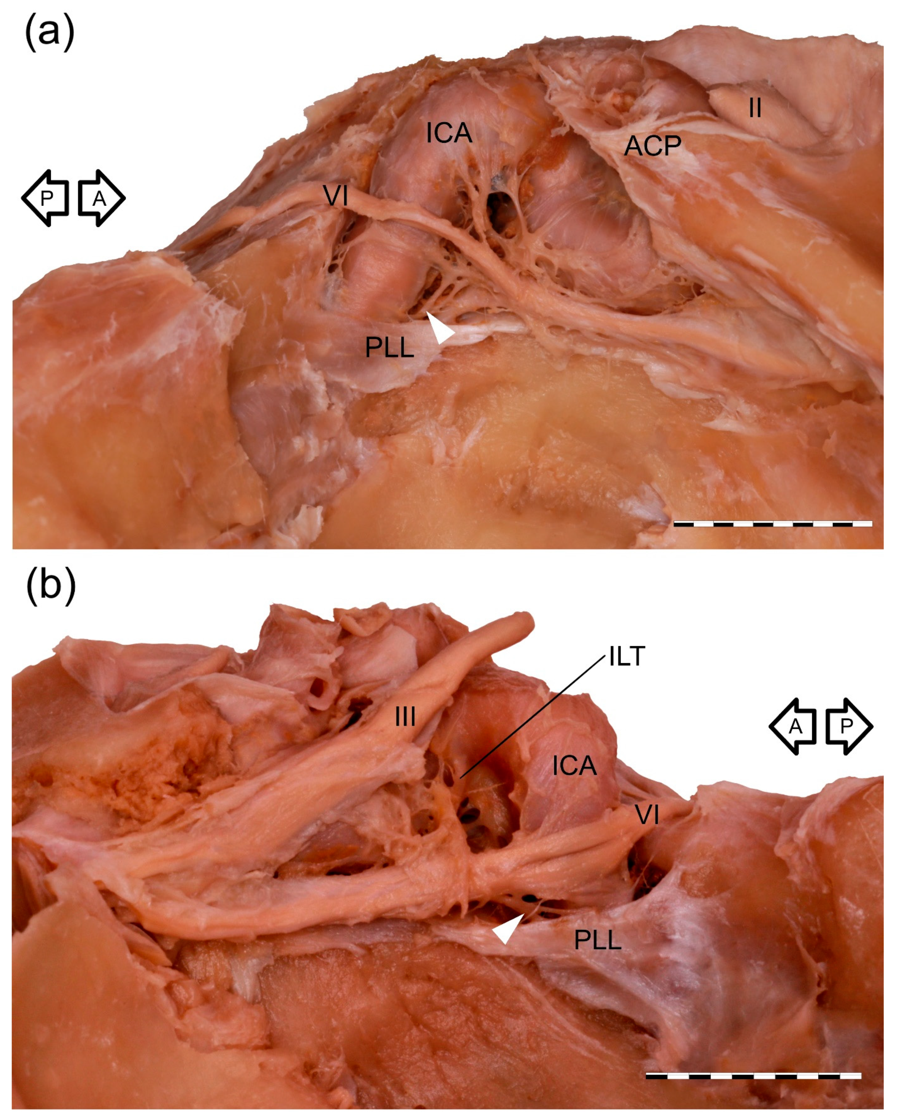 Brainsci 11 00649 g001 Brainsci 11 00649 g001