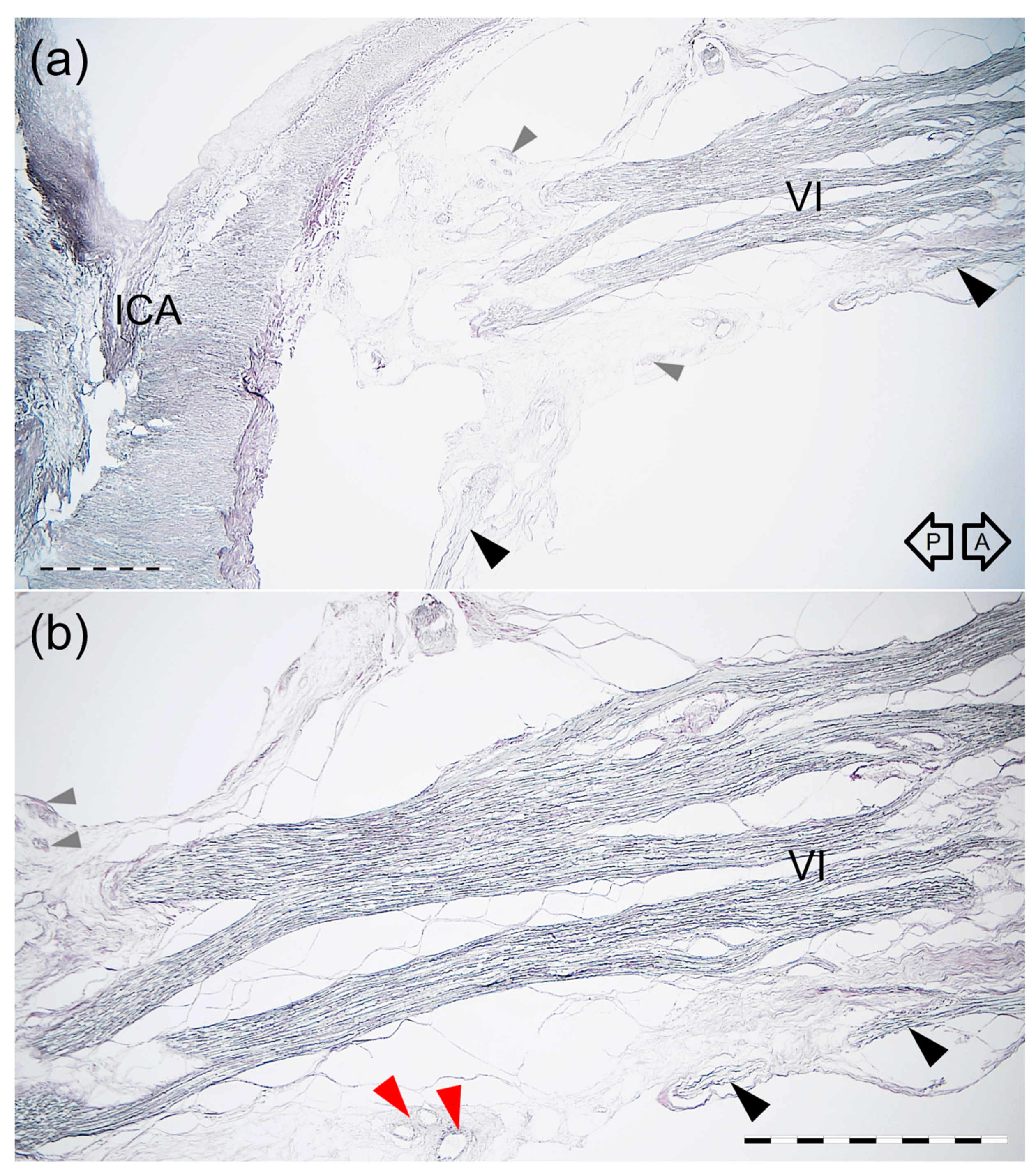 Brainsci 11 00649 g008 Brainsci 11 00649 g008