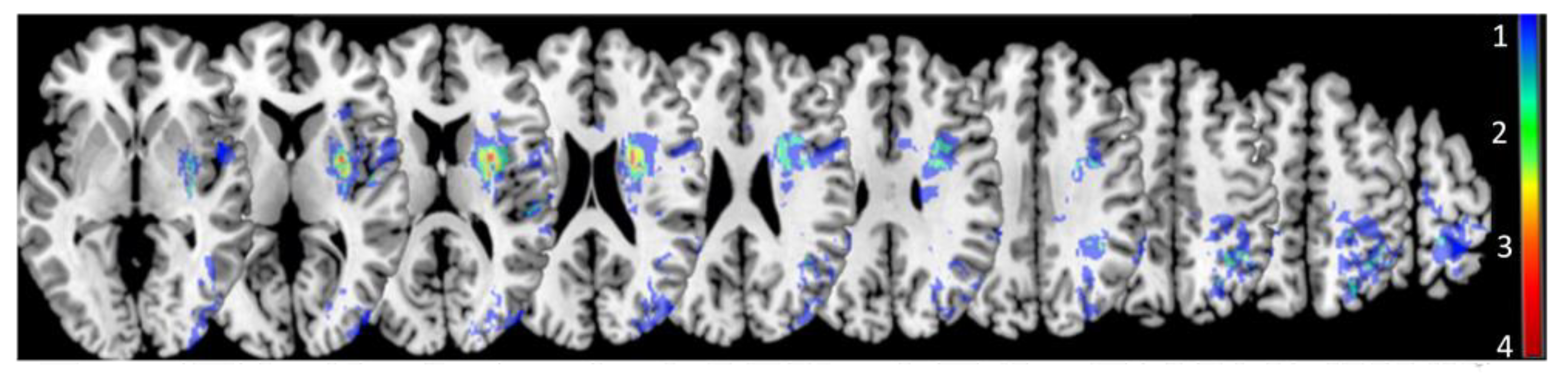 Brainsci 11 00667 g004