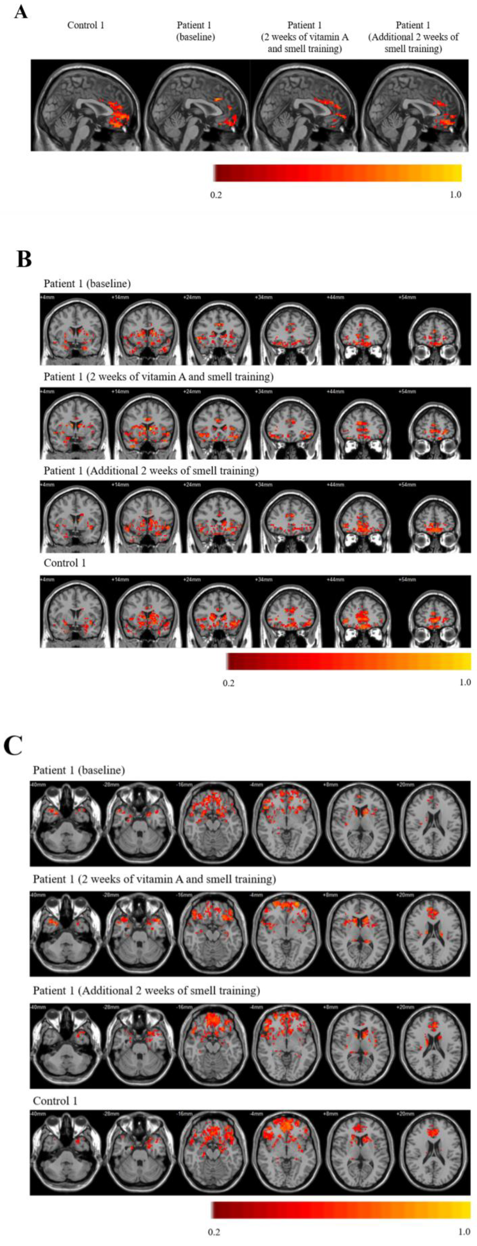 Brainsci 11 00686 g002