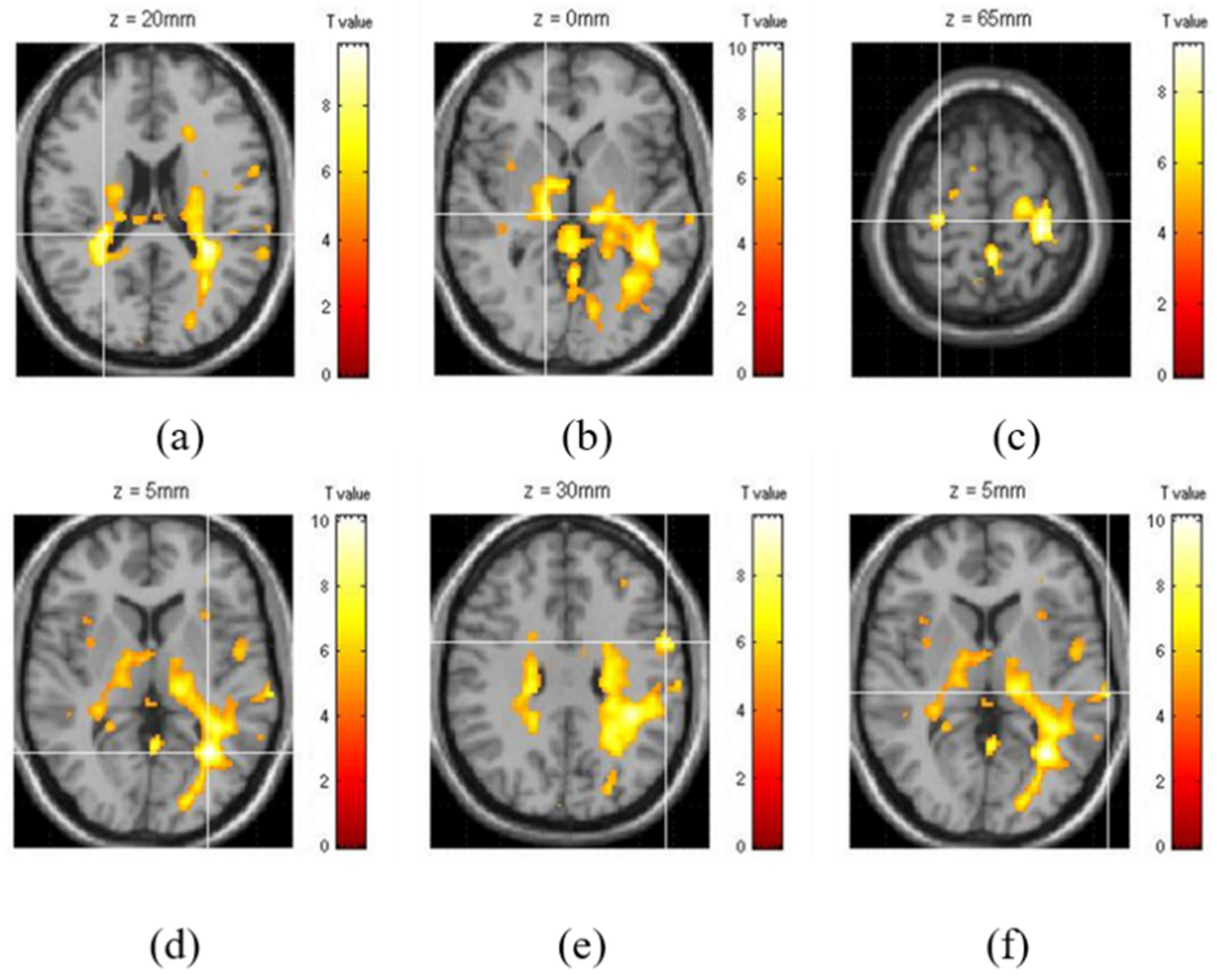 Brainsci 11 00690 g002 Brainsci 11 00690 g002