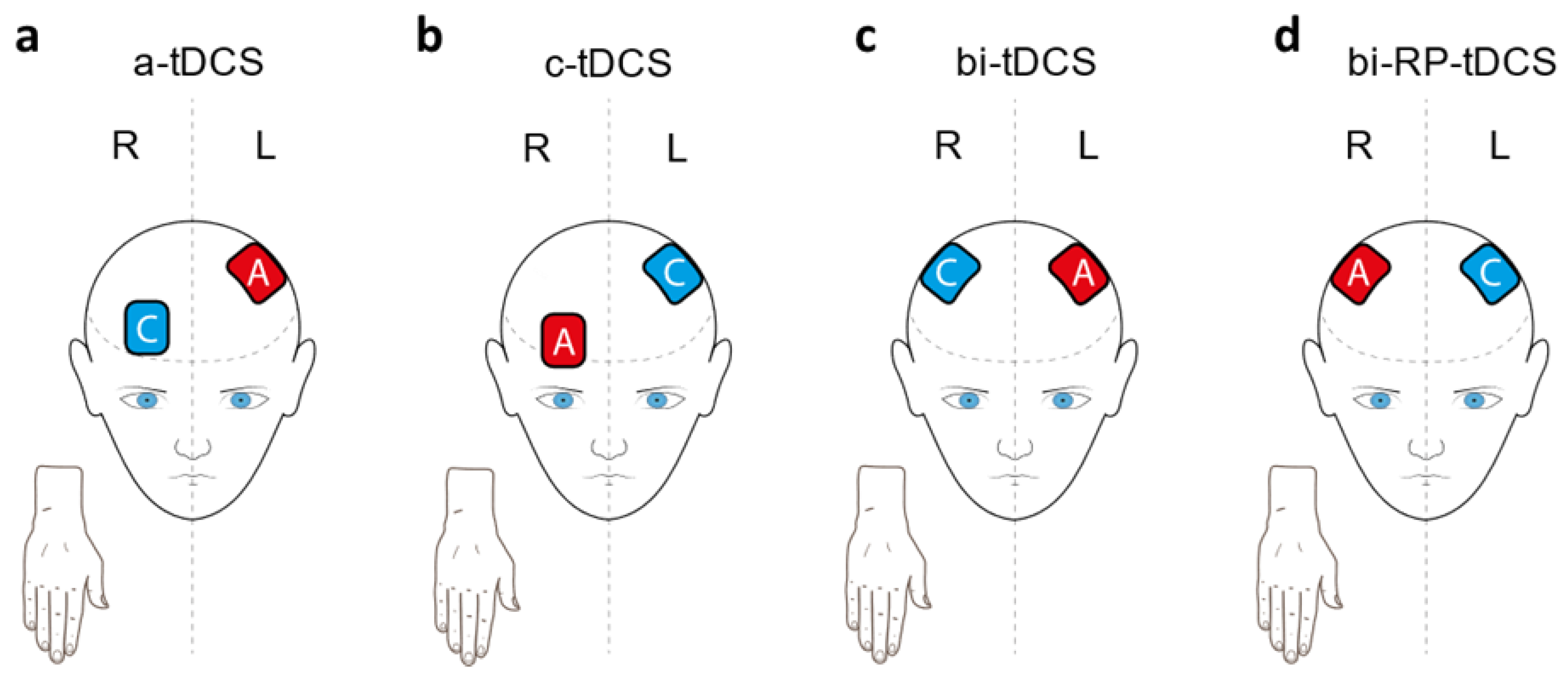 Brainsci 11 00691 g001 Brainsci 11 00691 g001