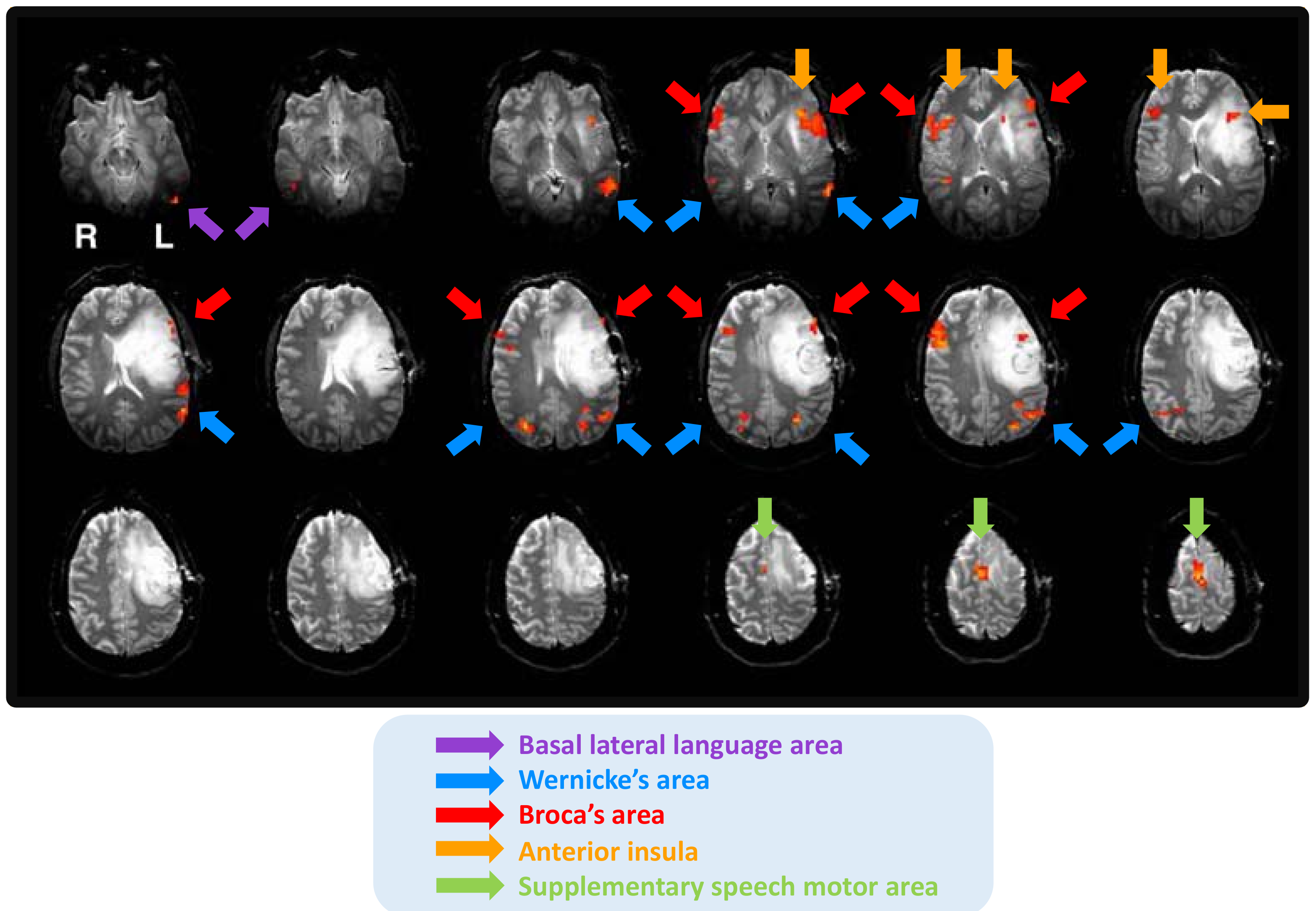 Brainsci 11 00694 g002 Brainsci 11 00694 g002