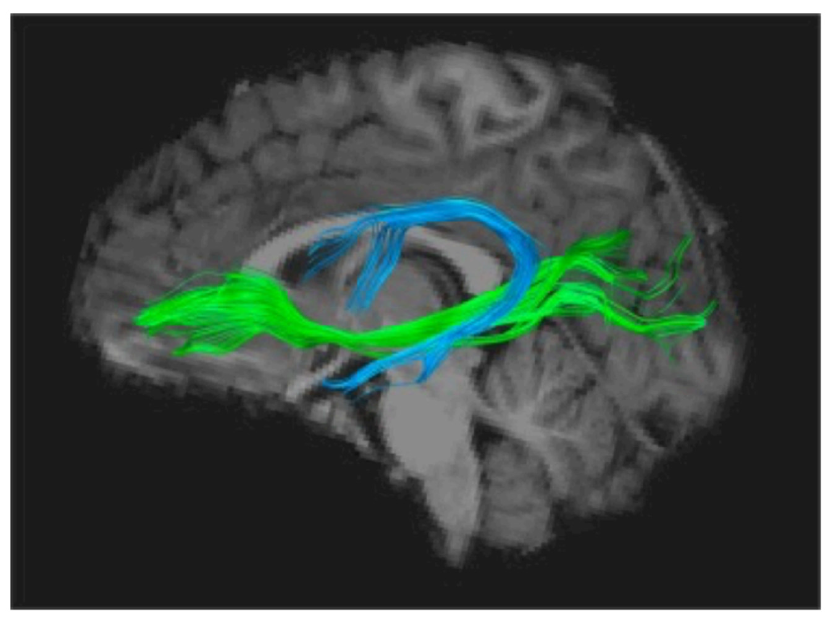 Brainsci 11 00708 g002