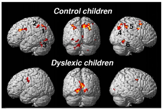 Brainsci 11 00708 g004 550