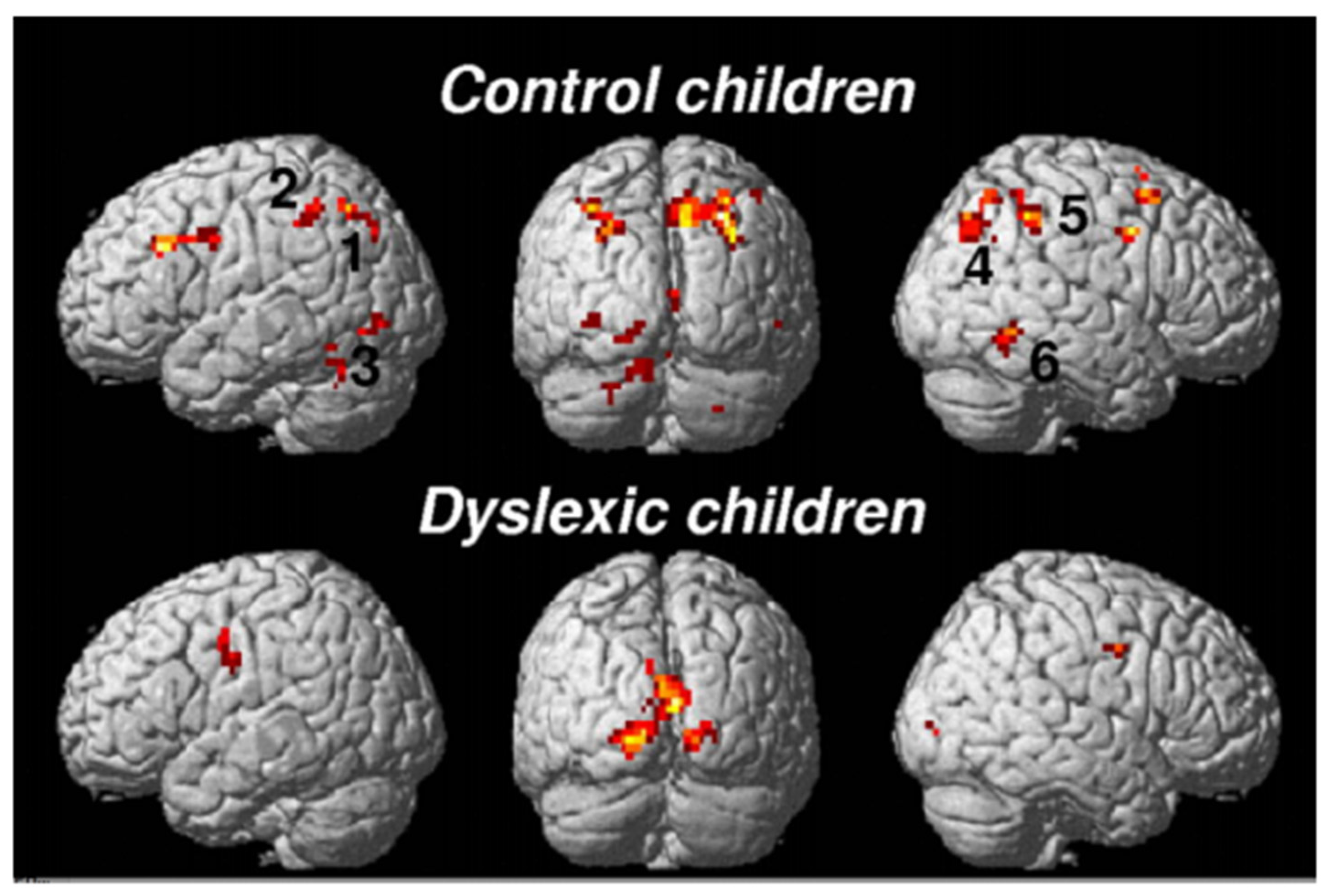 Brainsci 11 00708 g004