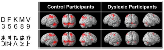 Brainsci 11 00708 g005 550