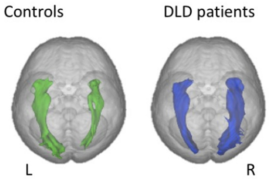 Brainsci 11 00708 g007 550