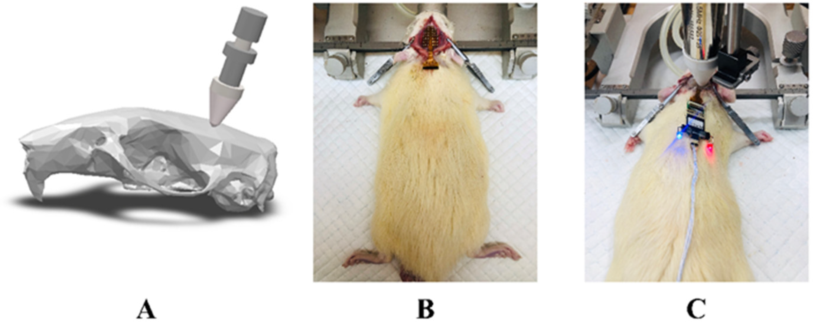 Brainsci 11 00711 g002 Brainsci 11 00711 g002