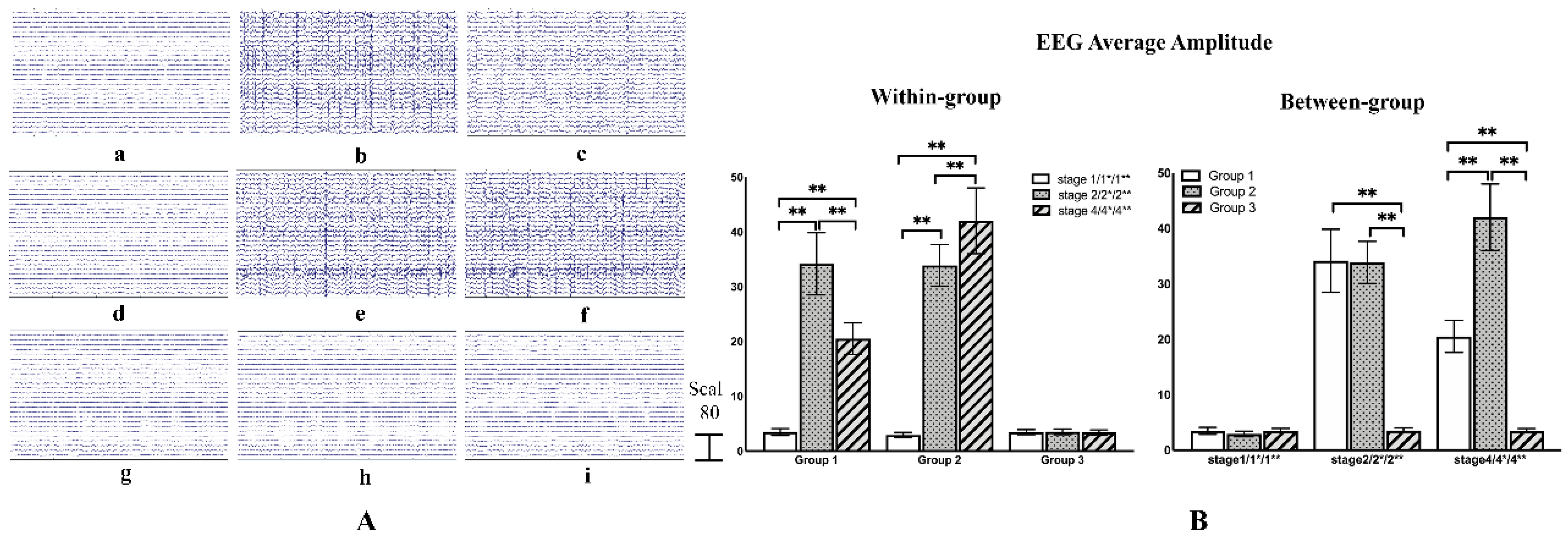 Brainsci 11 00711 g009 Brainsci 11 00711 g009