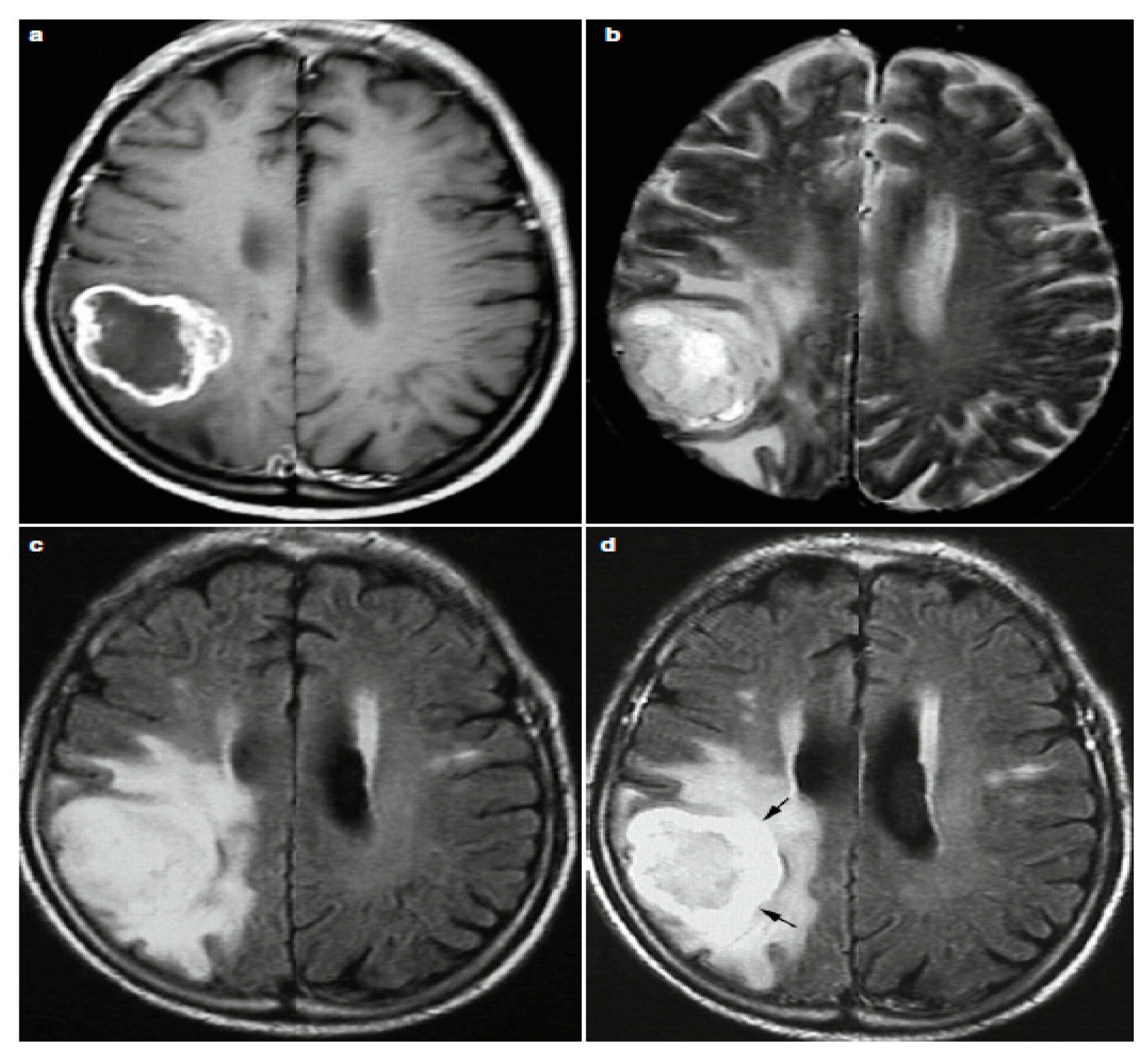 Brainsci 11 00716 g003