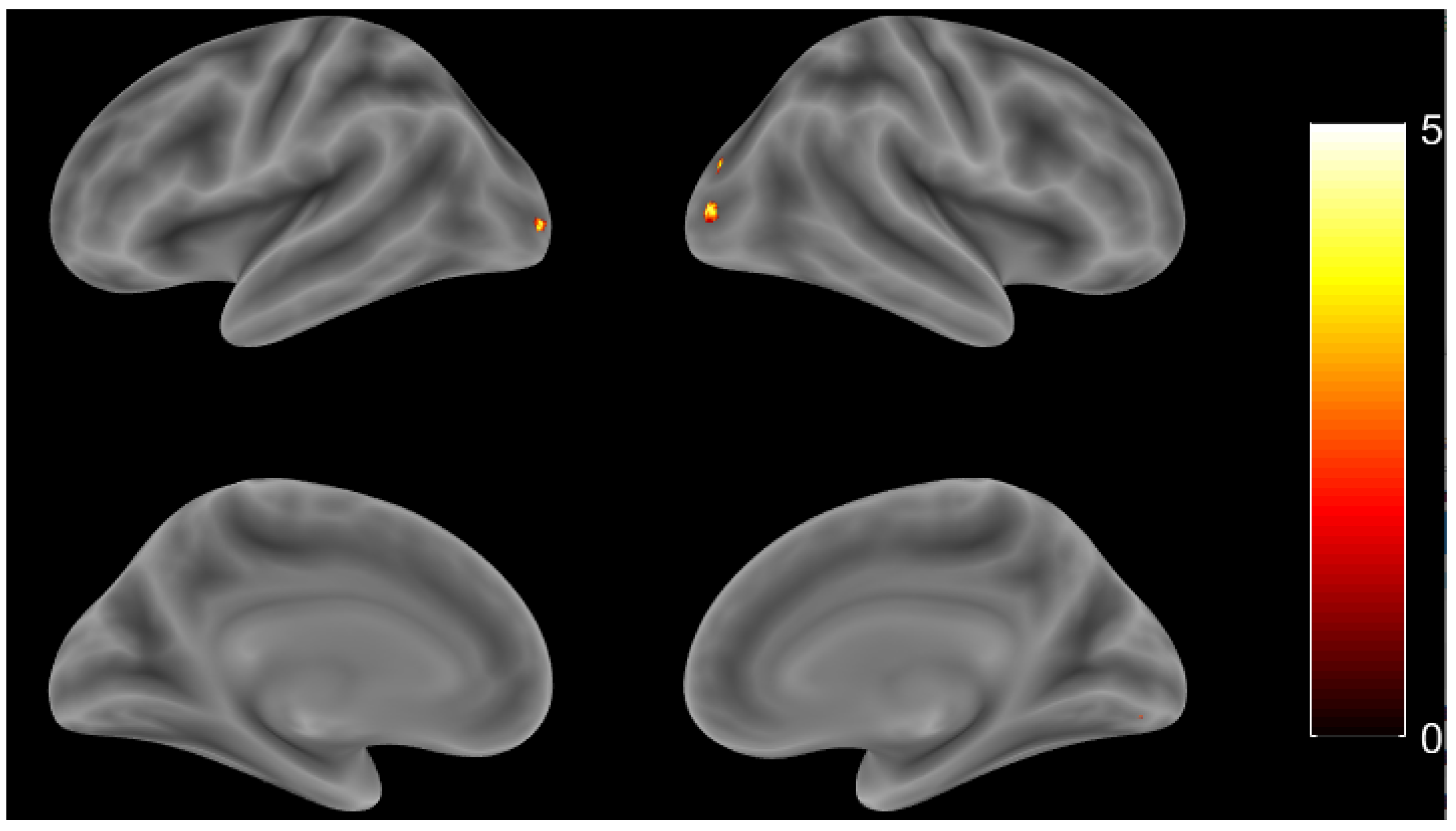 Brainsci 11 00718 g004