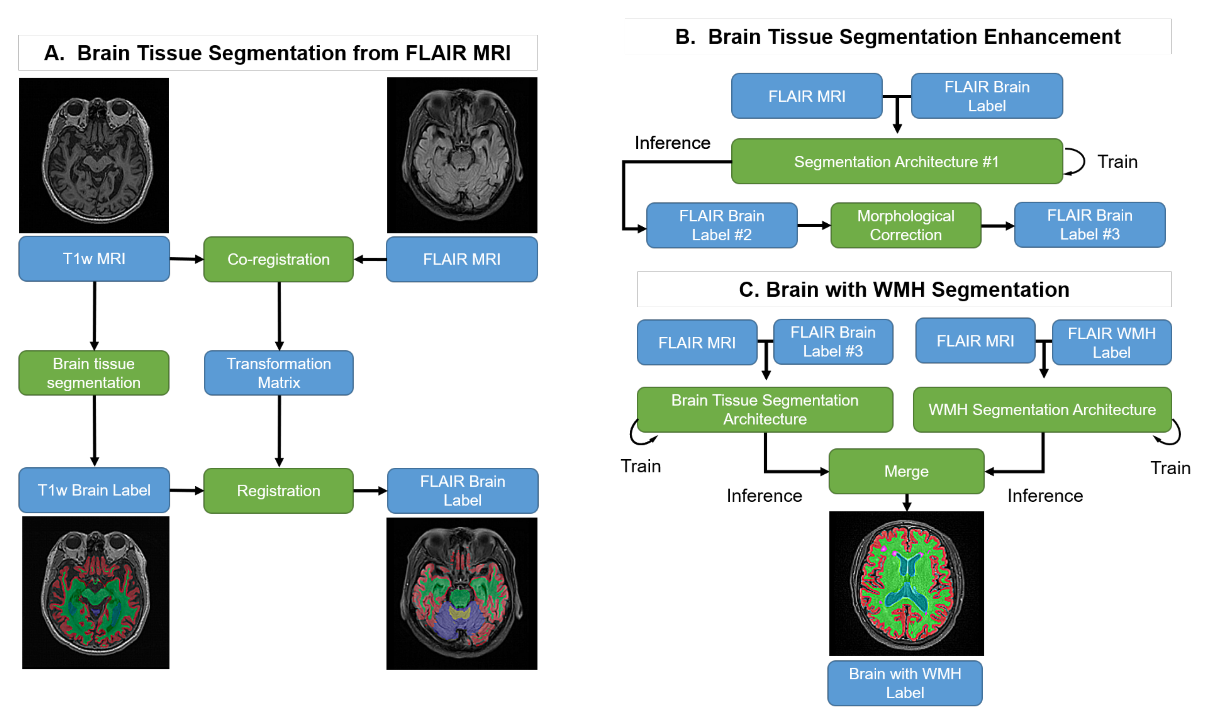 Brainsci 11 00720 g001 Brainsci 11 00720 g001