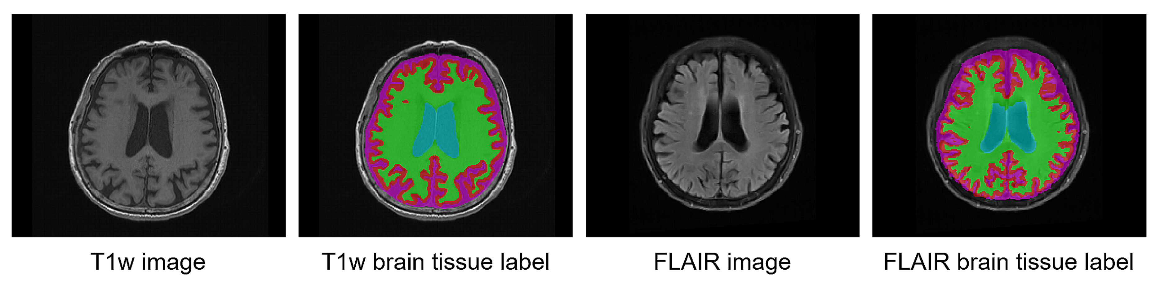 Brainsci 11 00720 g002 Brainsci 11 00720 g002