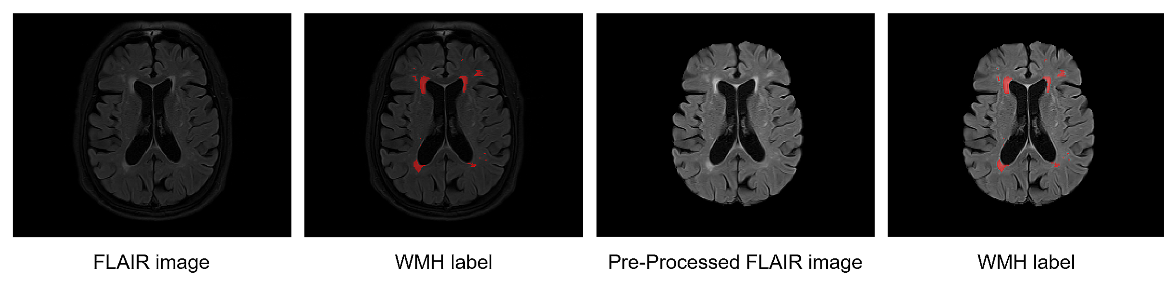Brainsci 11 00720 g003 Brainsci 11 00720 g003