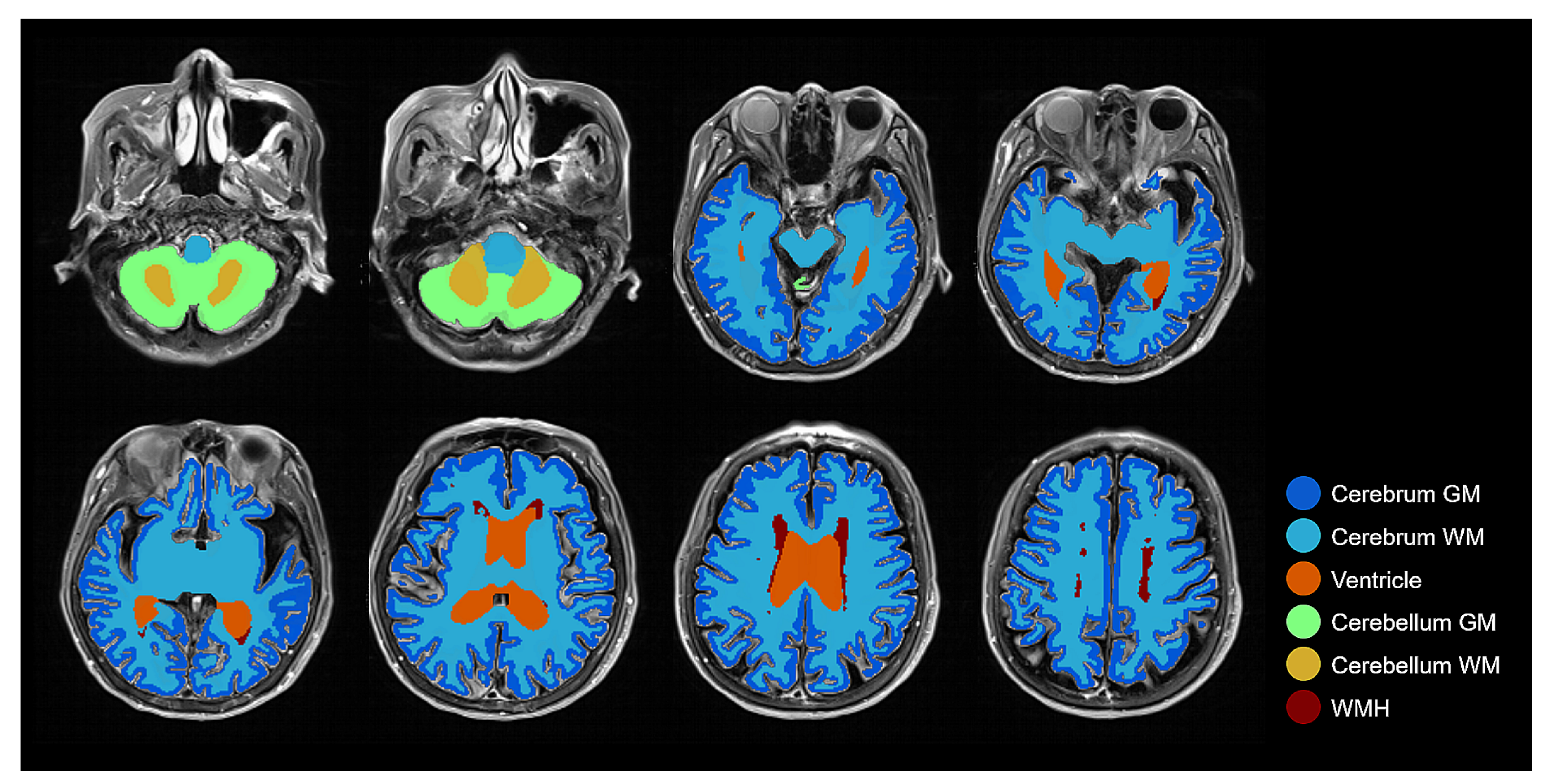 Brainsci 11 00720 g007 Brainsci 11 00720 g007
