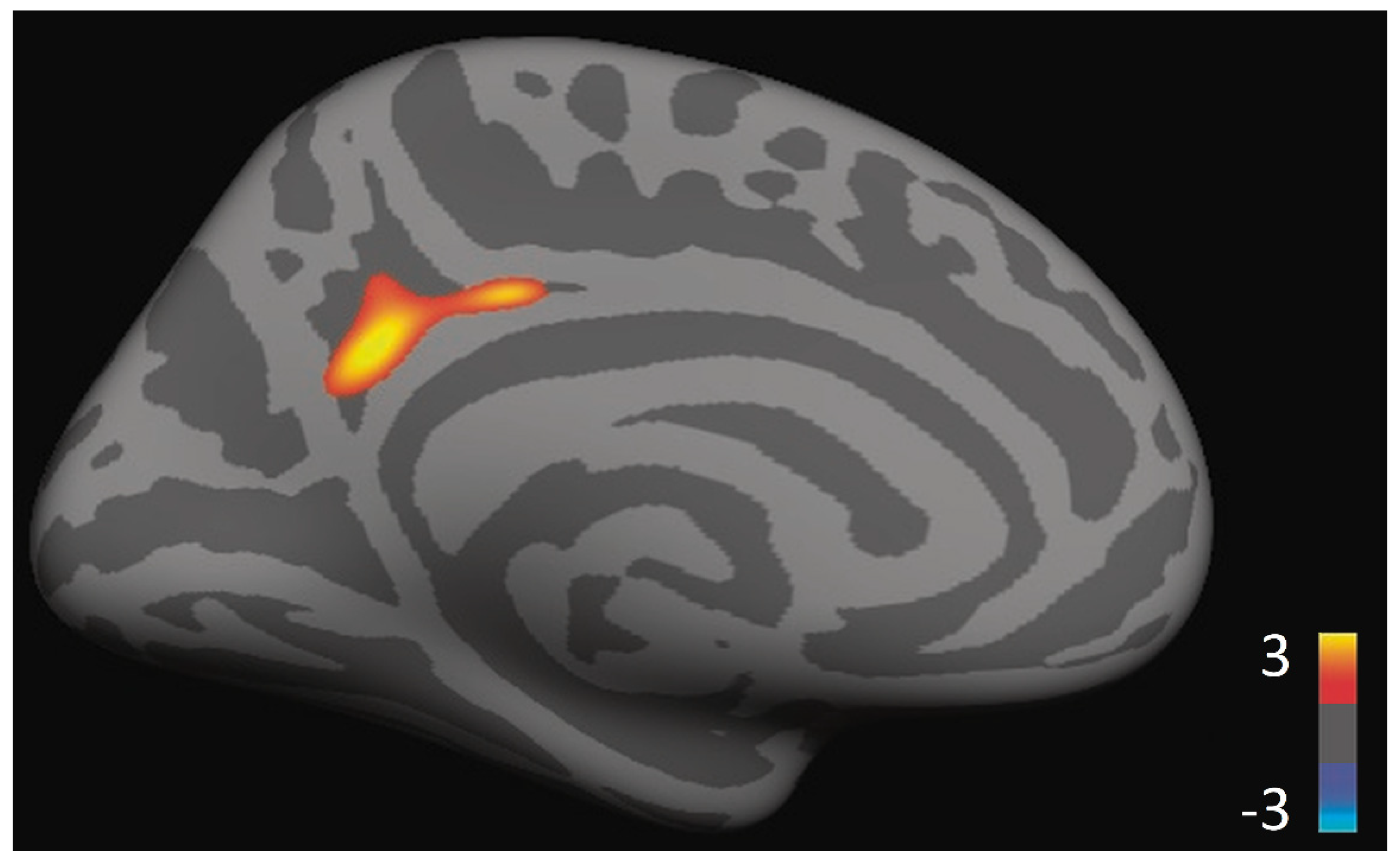 Brainsci 11 00728 g002 Brainsci 11 00728 g002