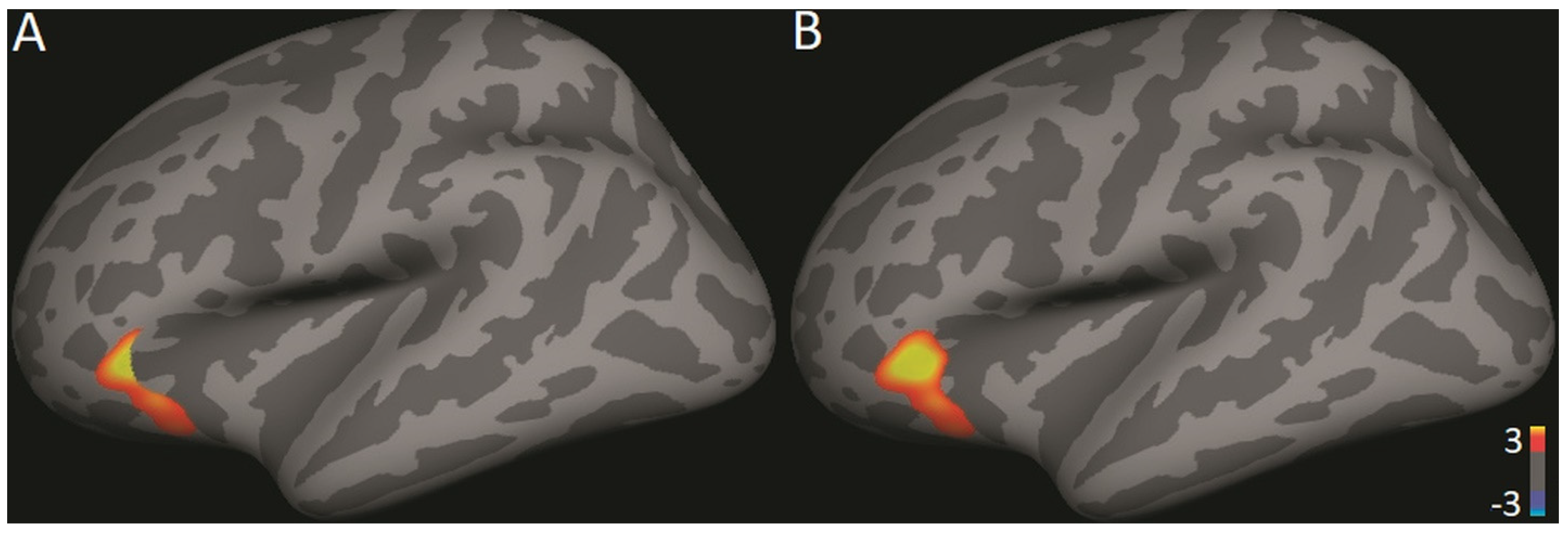 Brainsci 11 00728 g003 Brainsci 11 00728 g003