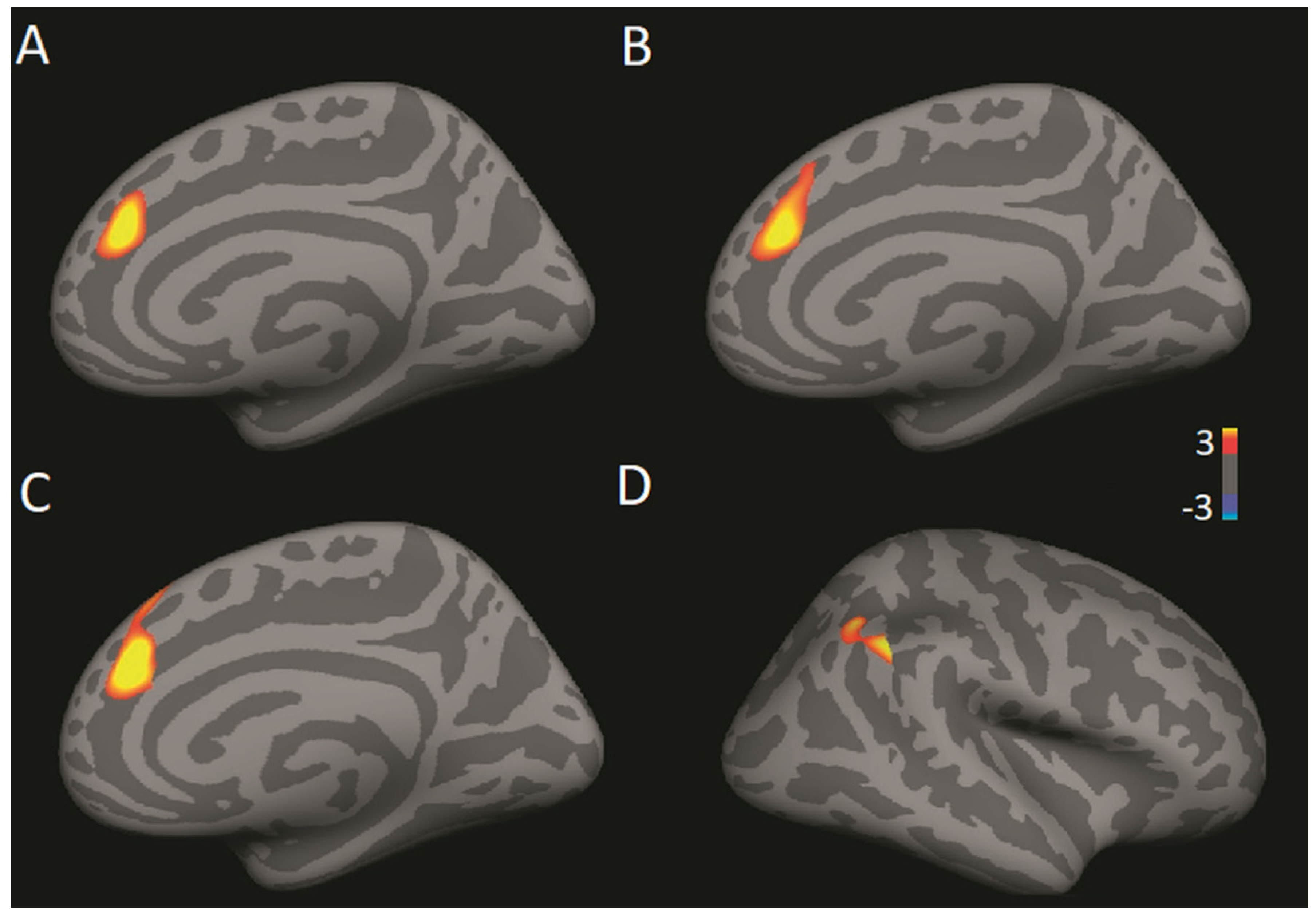 Brainsci 11 00728 g004 Brainsci 11 00728 g004