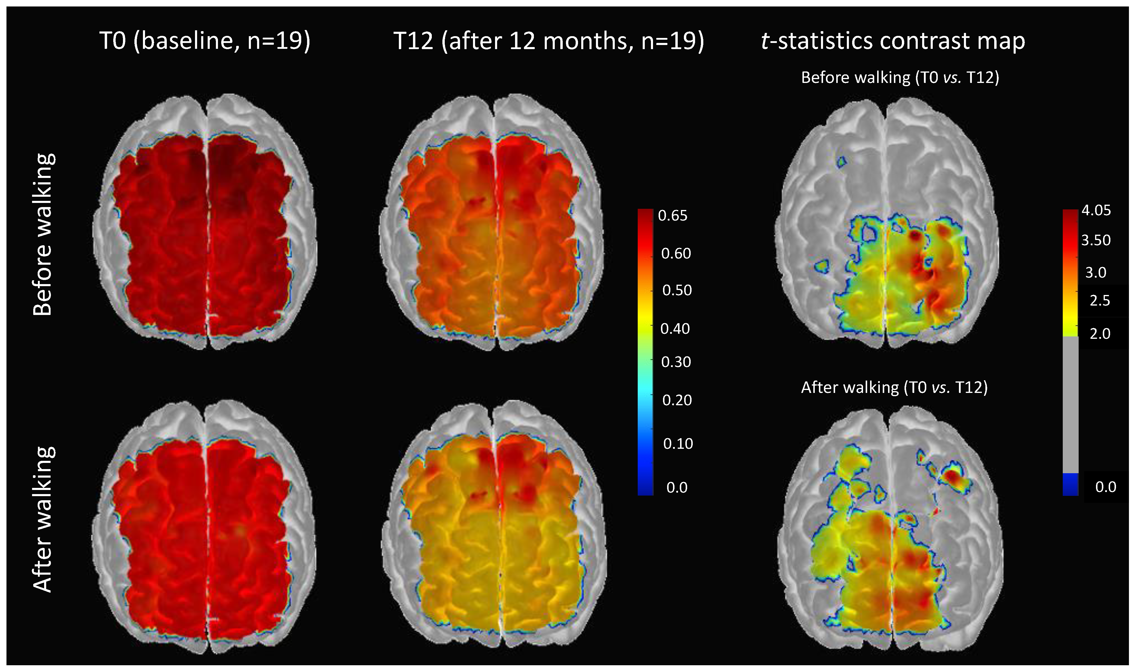 Brainsci 11 00730 g003 Brainsci 11 00730 g003