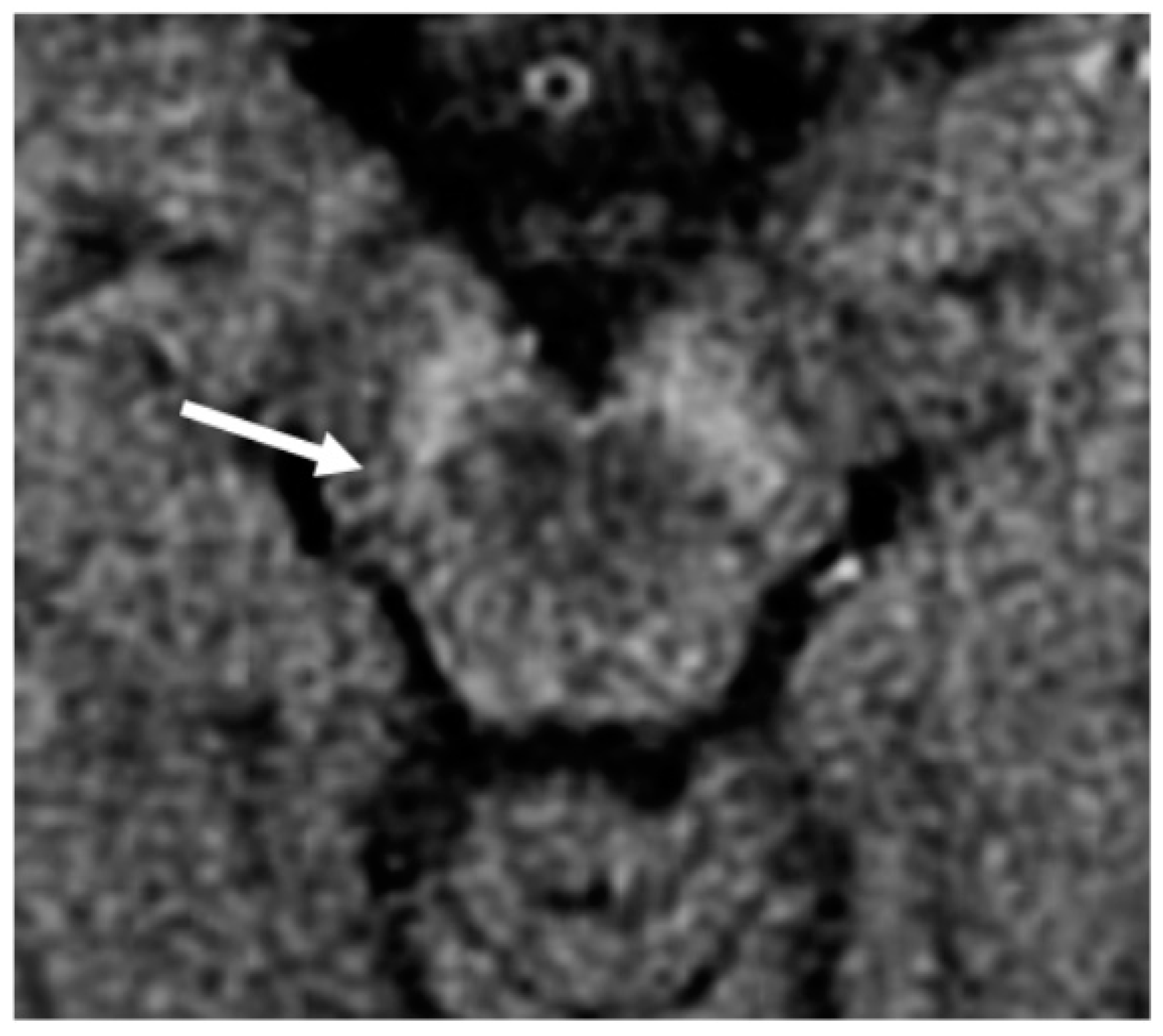 Brainsci 11 00769 g002 Brainsci 11 00769 g002