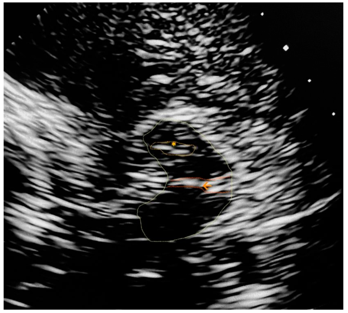 Brainsci 11 00776 g0a1 Brainsci 11 00776 g0a1