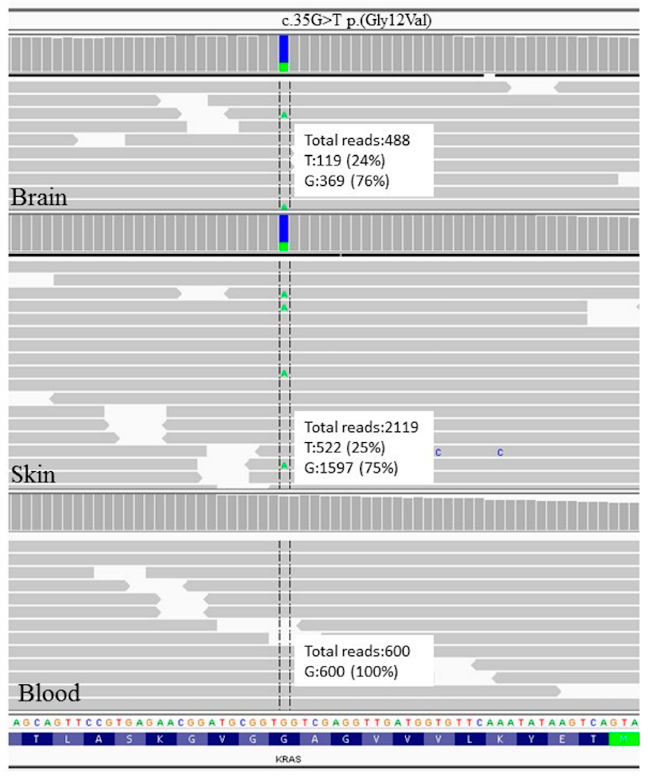 Brainsci 11 00793 g004