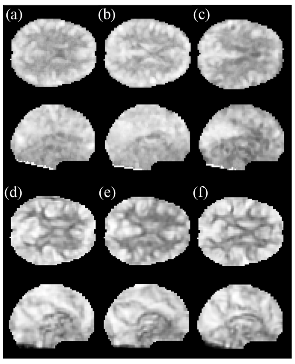 Brainsci 11 00809 g002 Brainsci 11 00809 g002