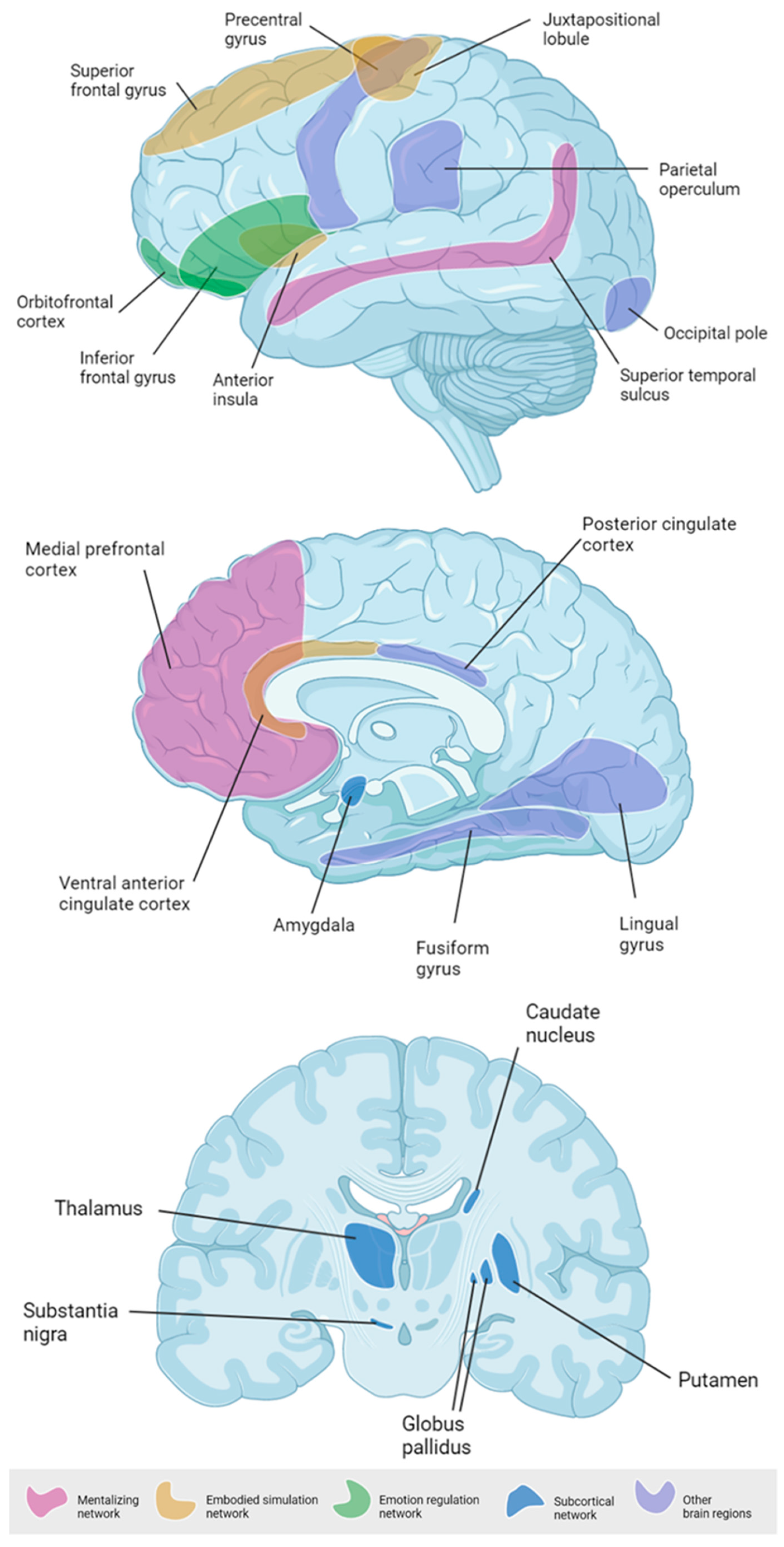 Brainsci 11 00816 g003 Brainsci 11 00816 g003