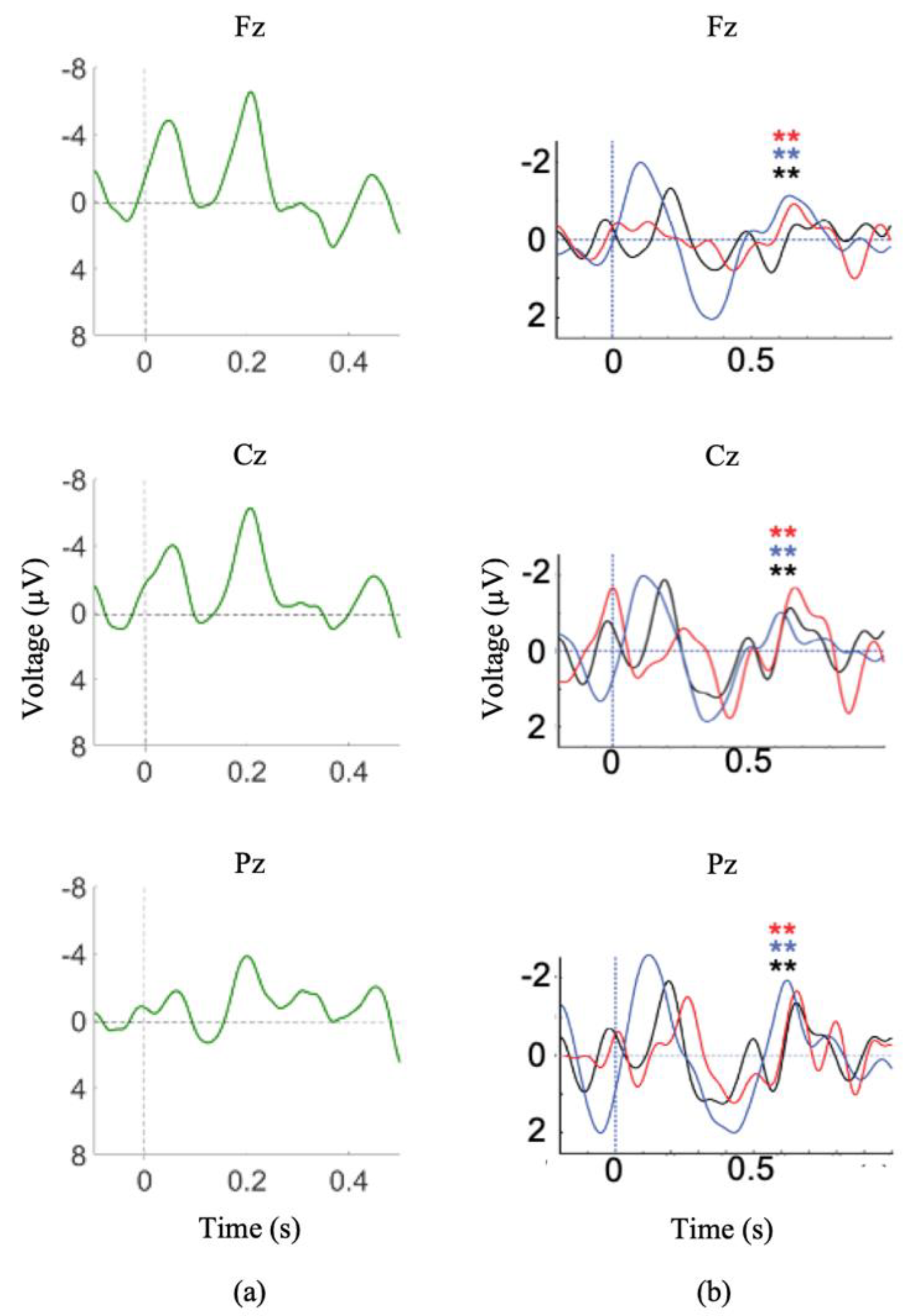 Brainsci 11 00835 g004 Brainsci 11 00835 g004