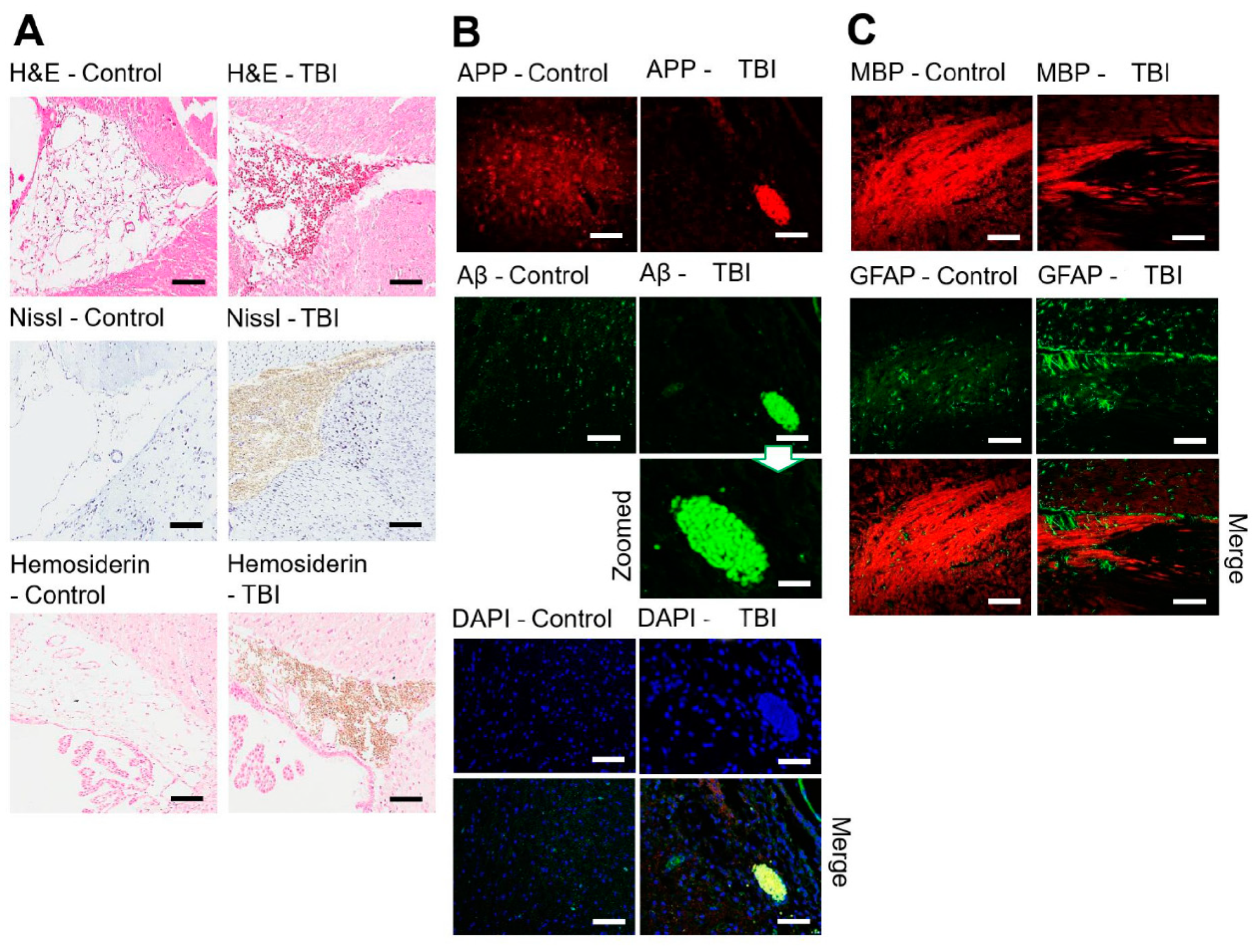 Brainsci 11 00918 g002