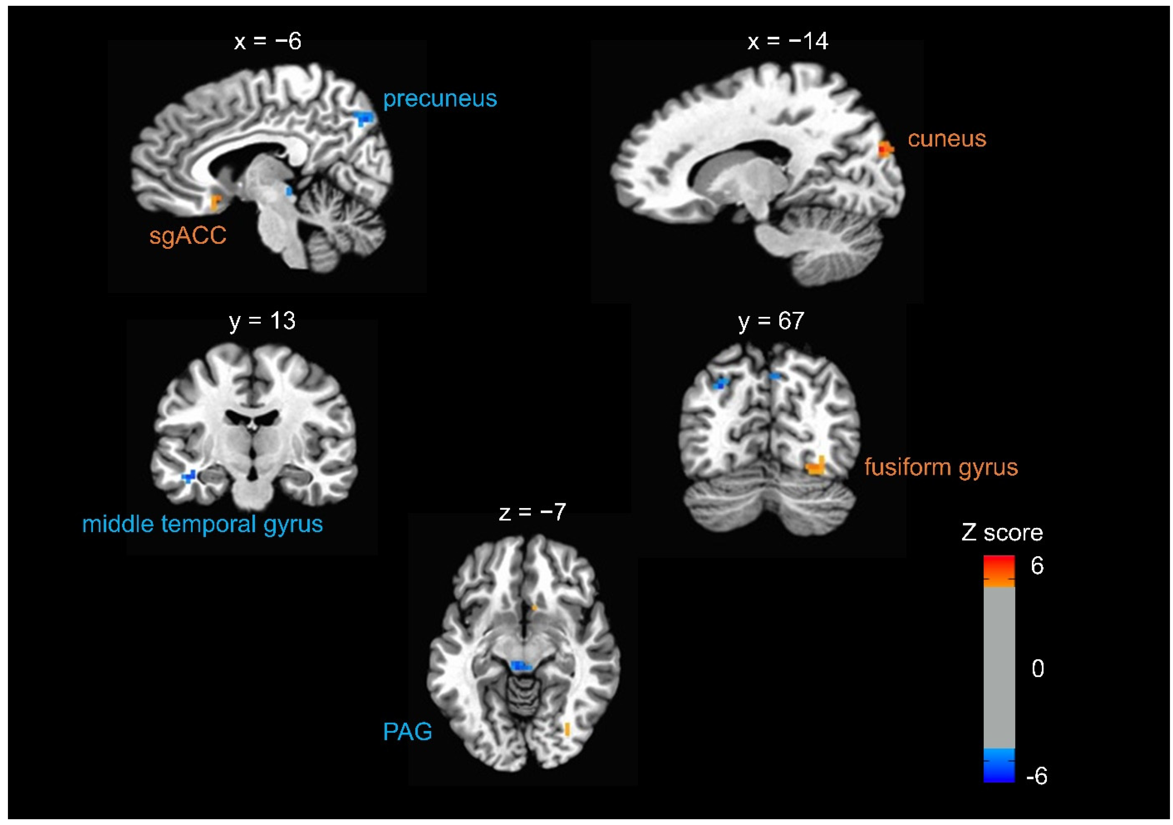Brainsci 11 00946 g003 550