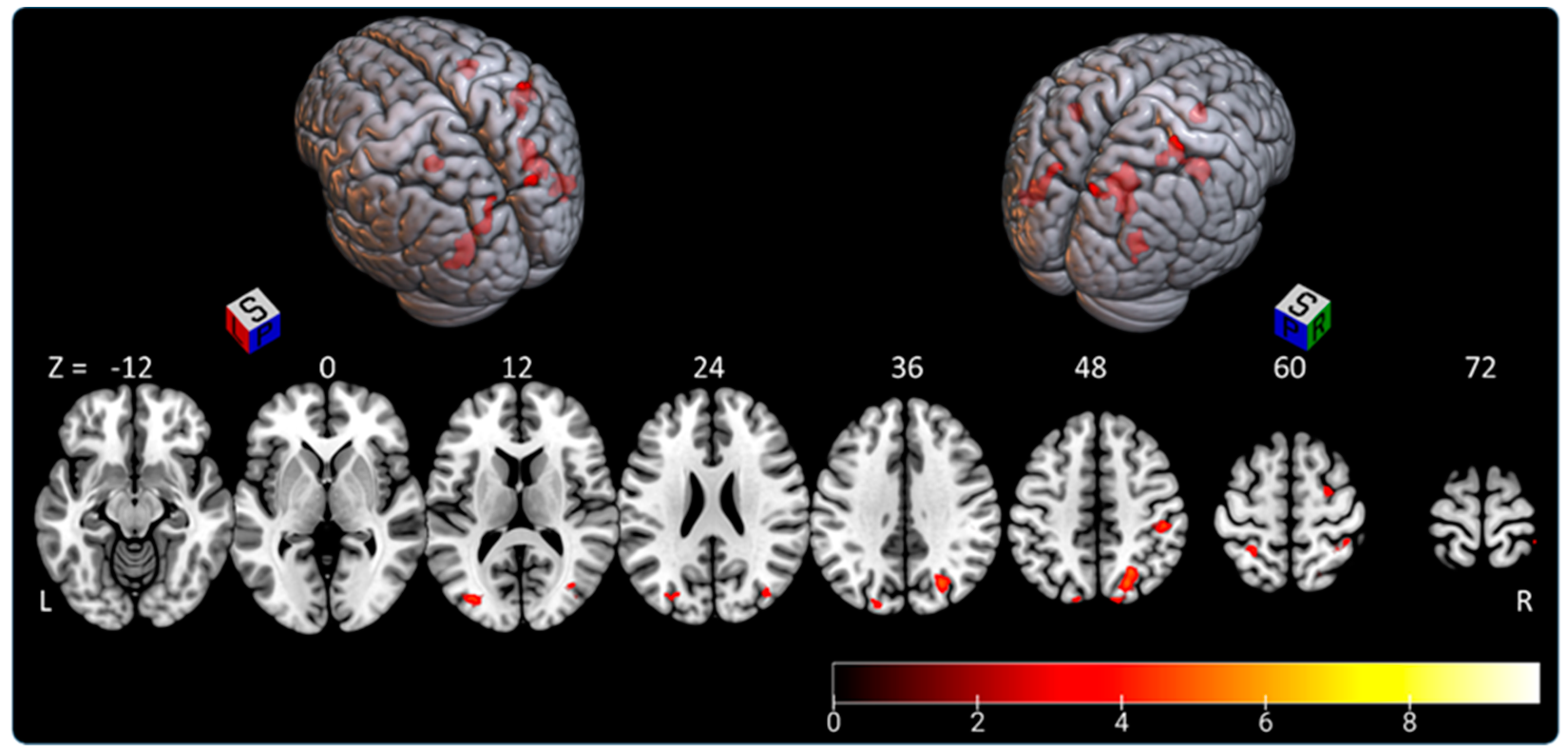 Brainsci 11 00963 g003