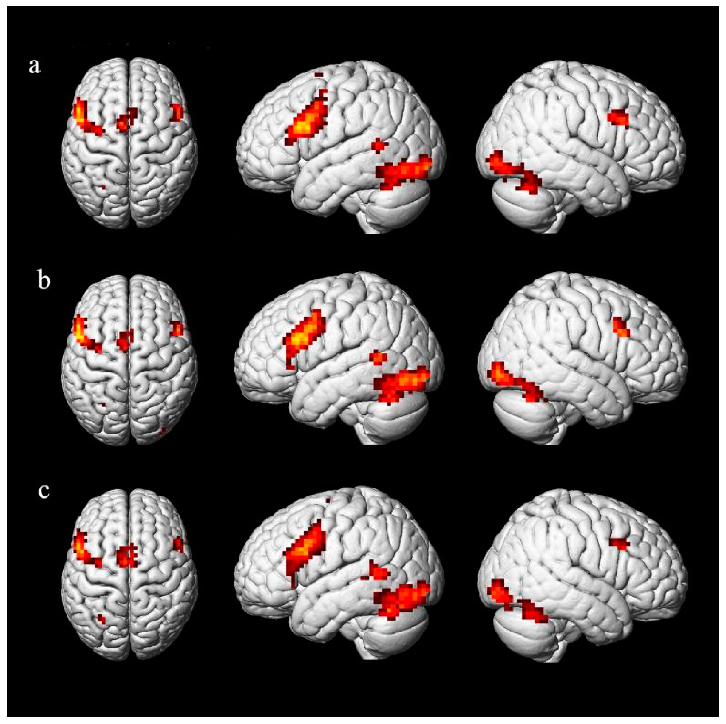 Brainsci 11 00983 g006 550